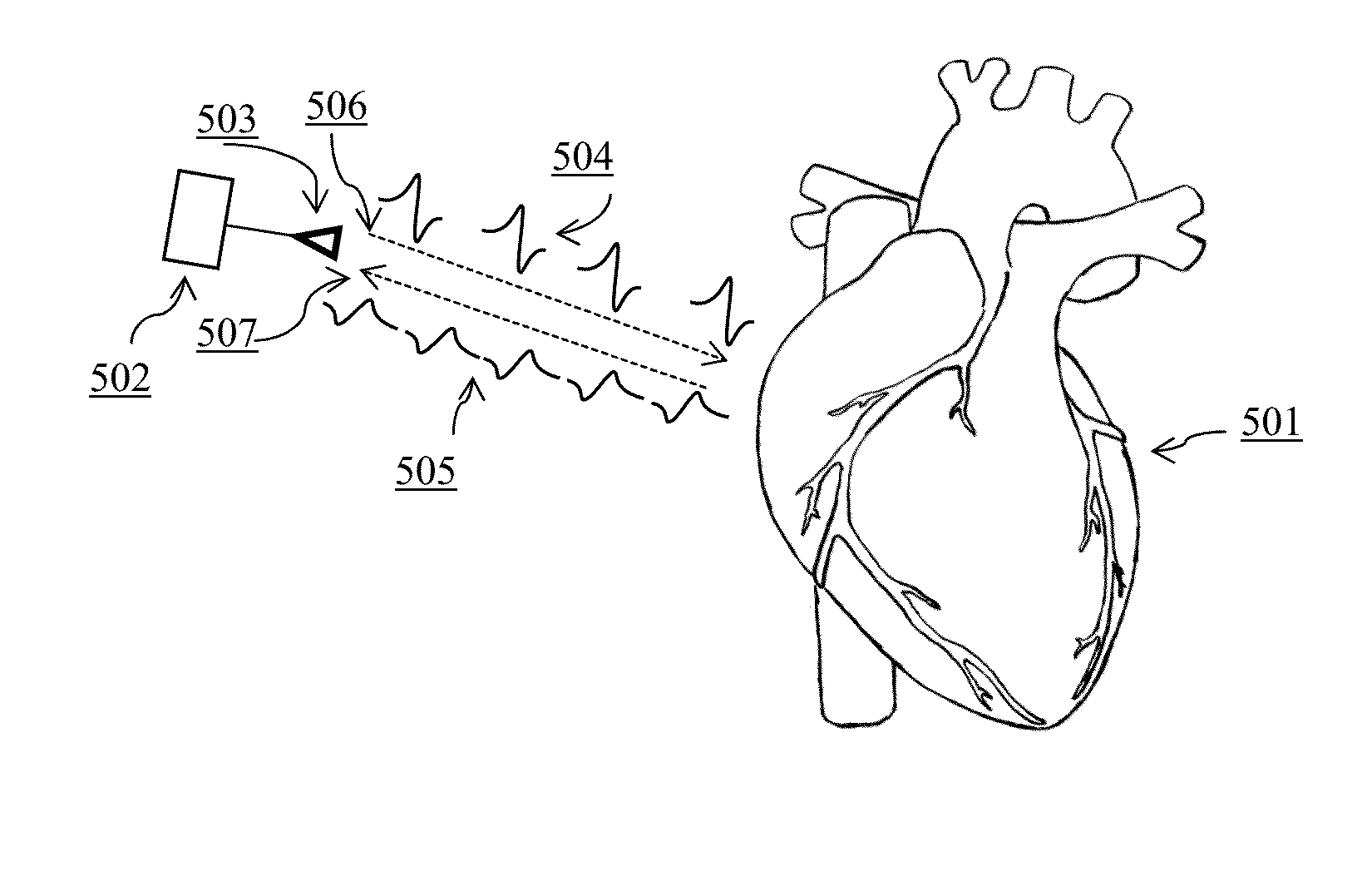 Portable Heart Motion Monitor