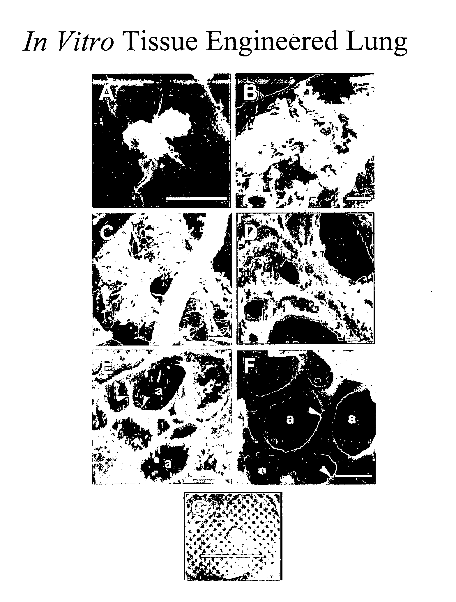 Engineered lung tissue, hydrogel/somatic lung progenitor cell constructs to support tissue growth, and method for making and using same