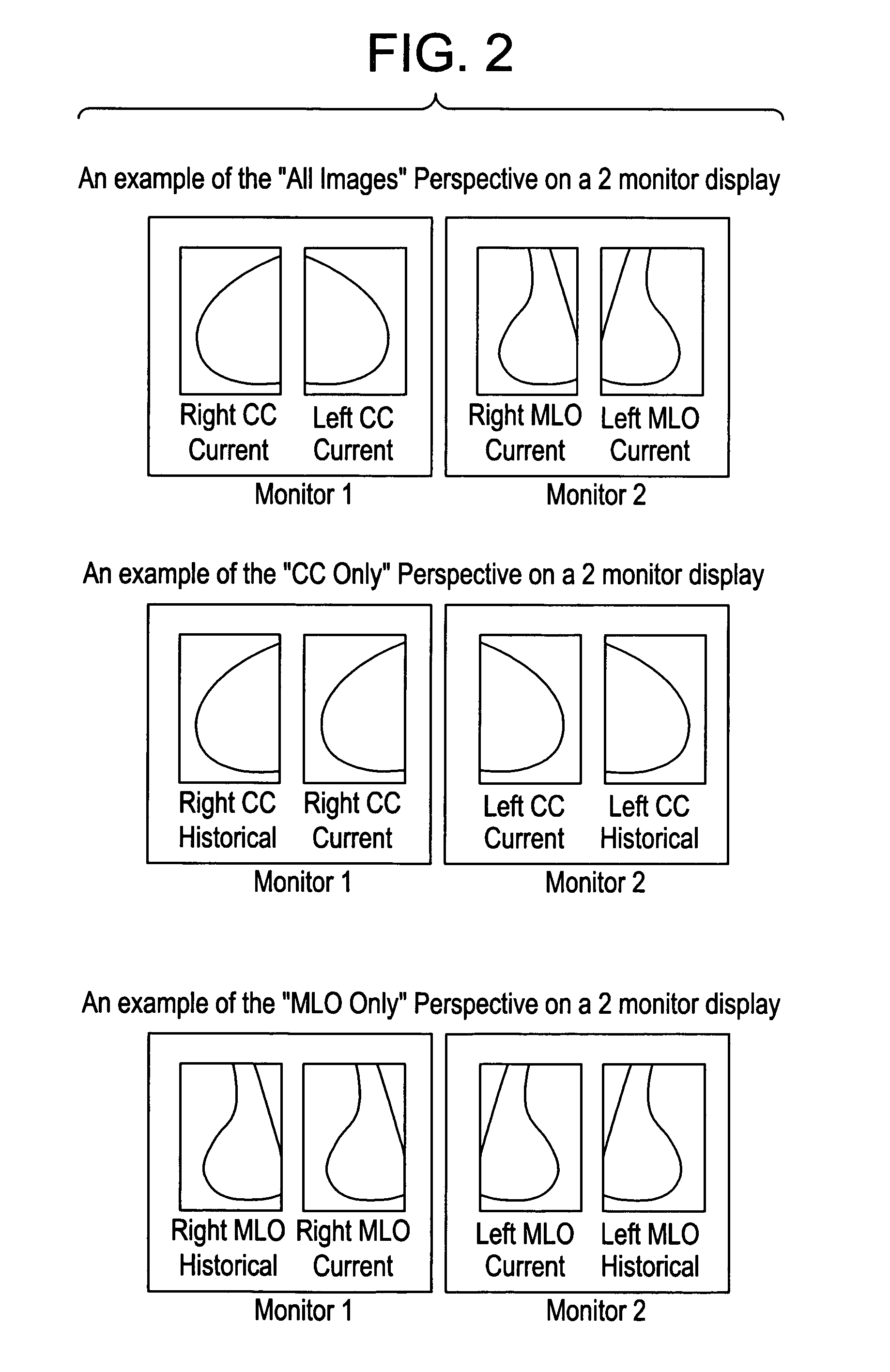 System and method for perspective-based procedure analysis