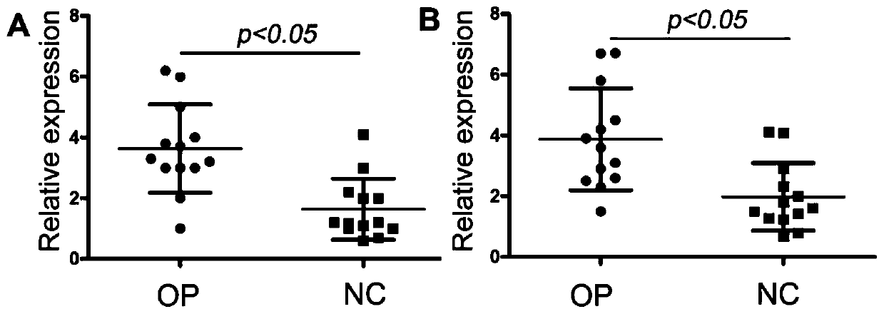 Application of long non-coding lncRNA-od1 in osteoporosis disease