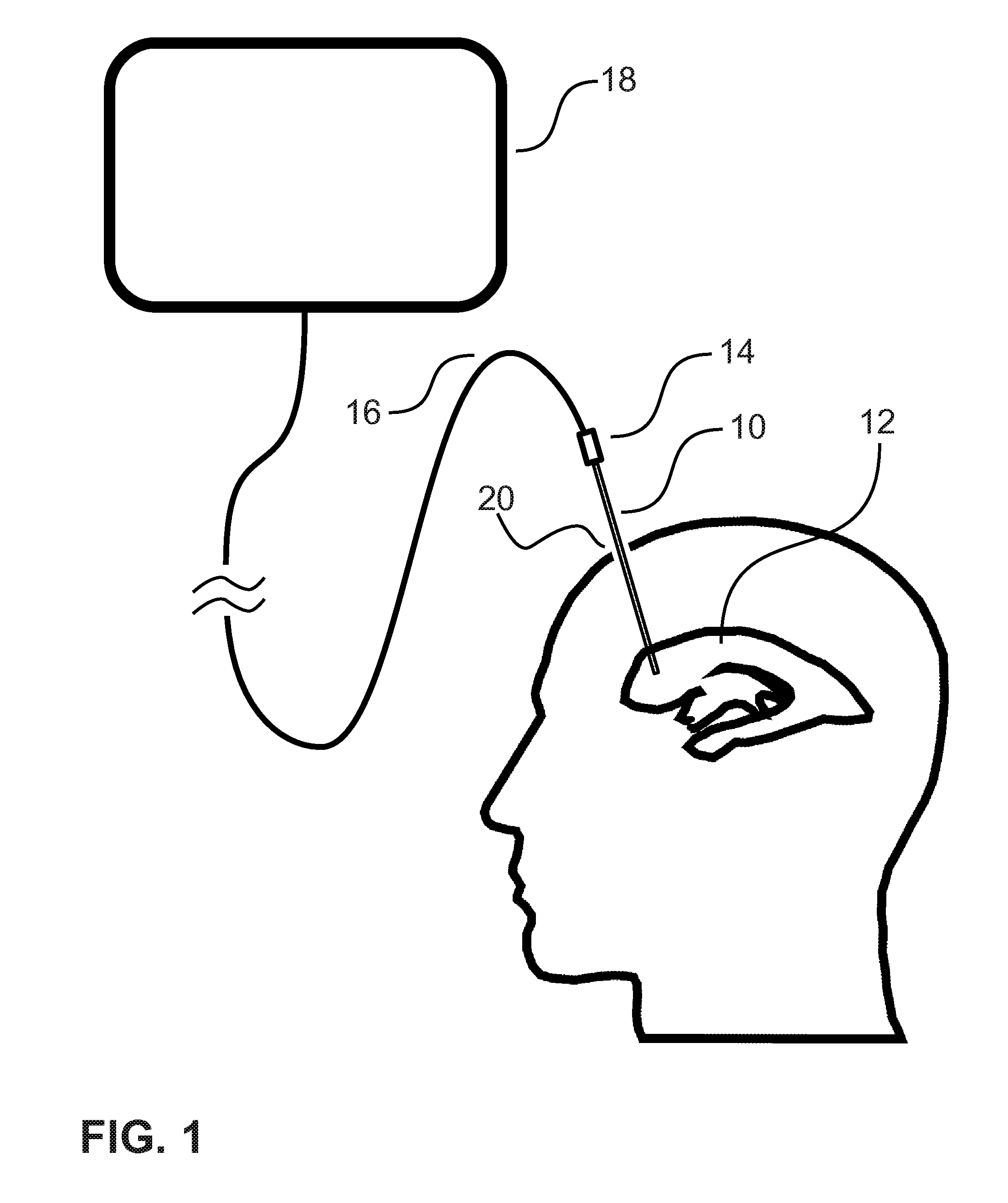 System and method for inserting intracranial catheters