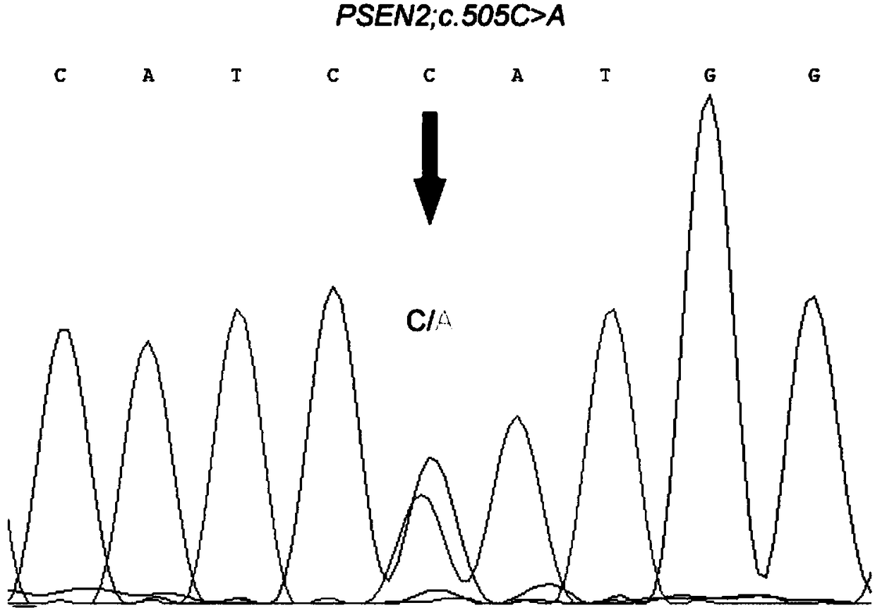 Nucleic acid related to Alzheimer's disease and application of nucleic acid