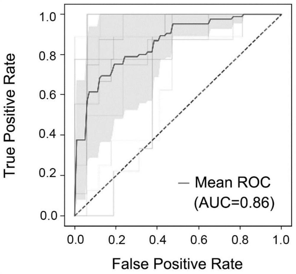 Application of miRNA combined marker in preparation of kit for diagnosing and detecting early liver cancer