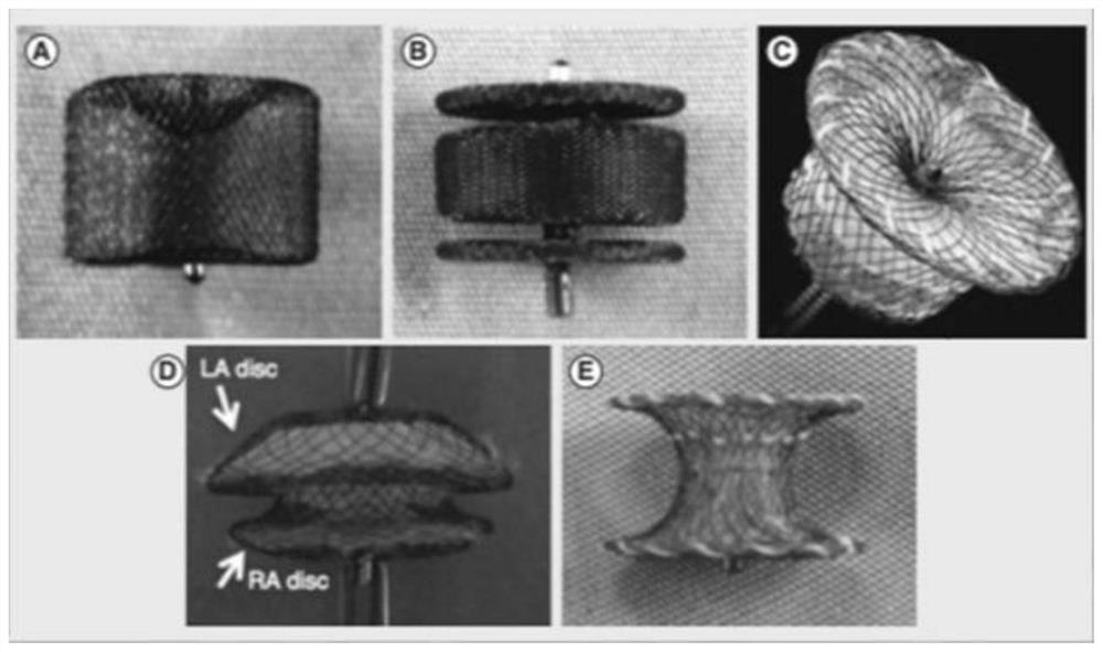 Novel double-layer occluder