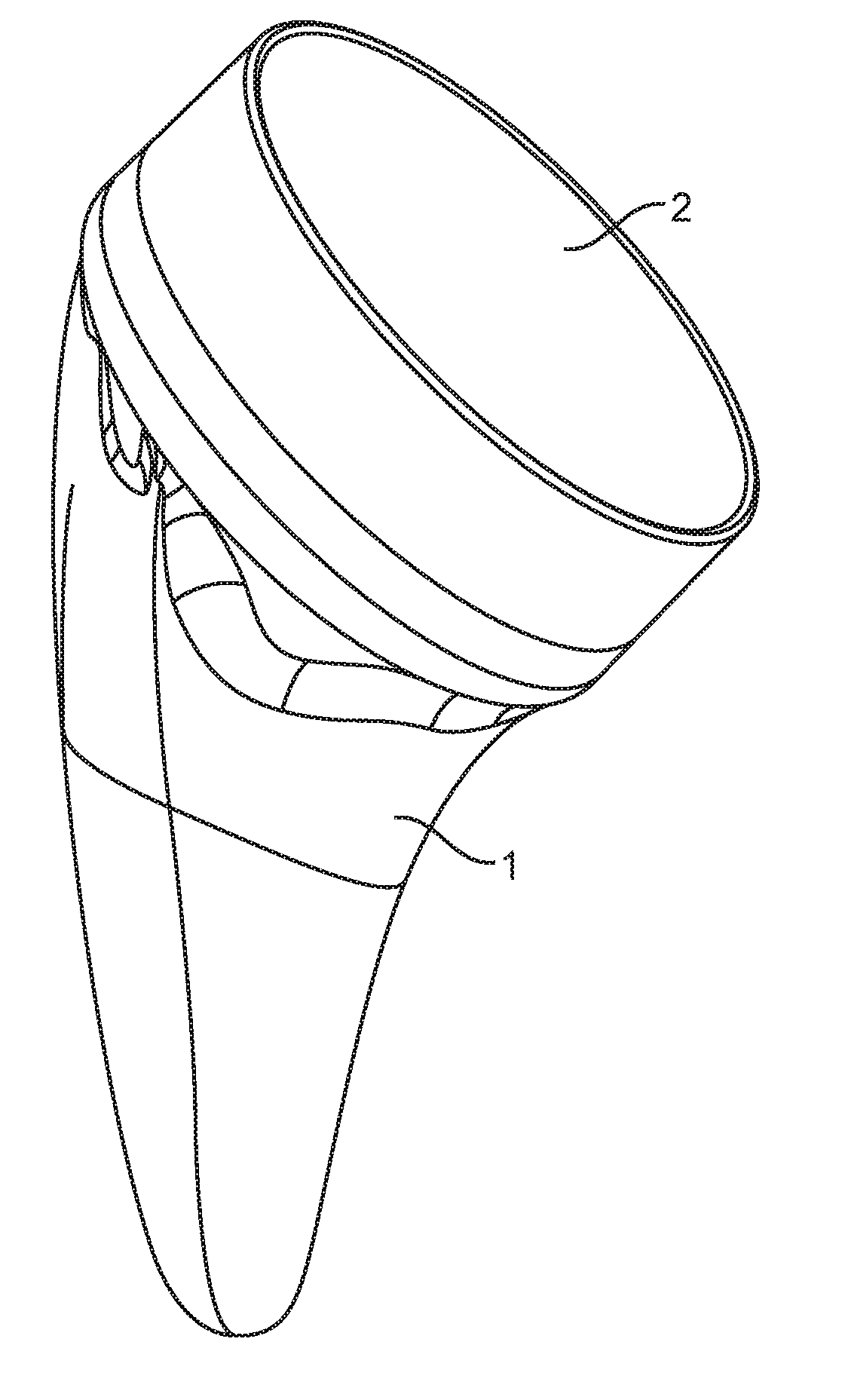 Shoulder arthroplasty implant system