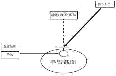 Vein viewing system