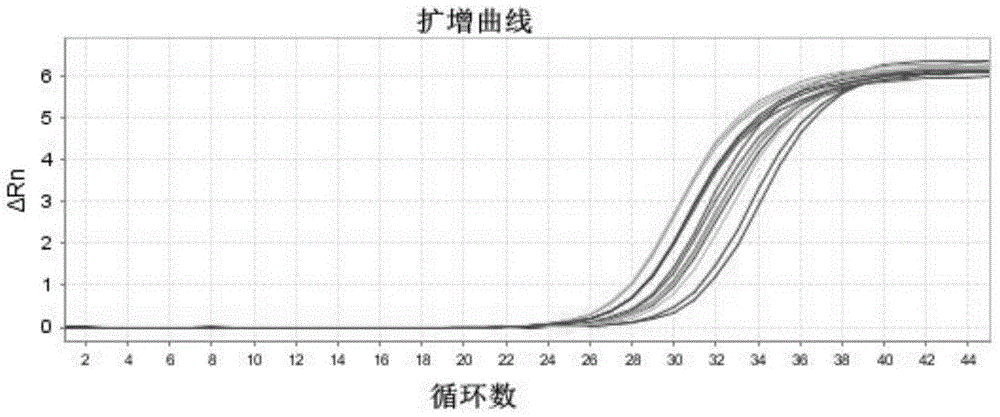 Application of carbonic anhydrase iv in preparation of lung adenocarcinoma diagnostic preparation