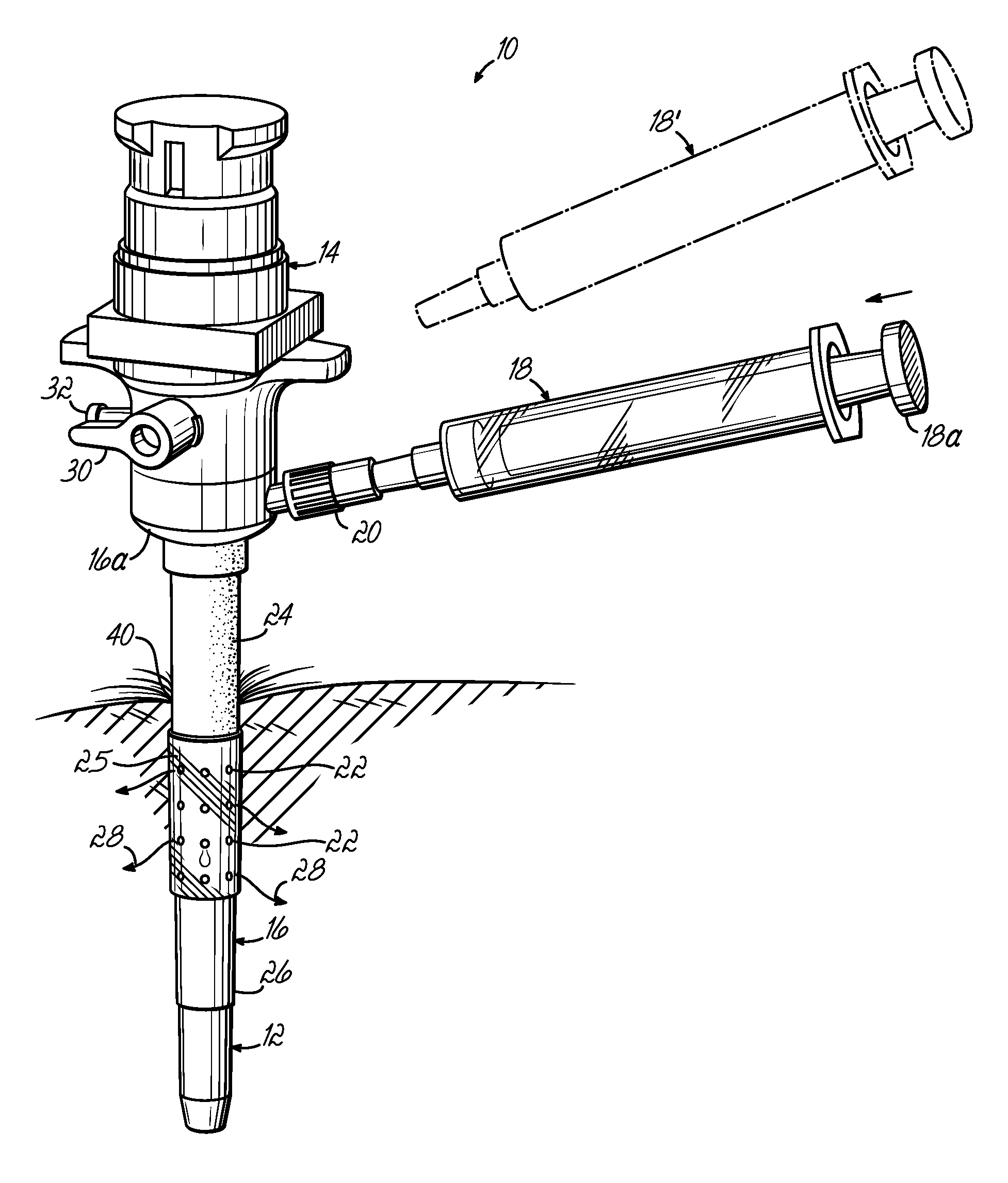 Trocar-cannula complex, cannula and method for delivering biologically active agents during minimally invasive surgery