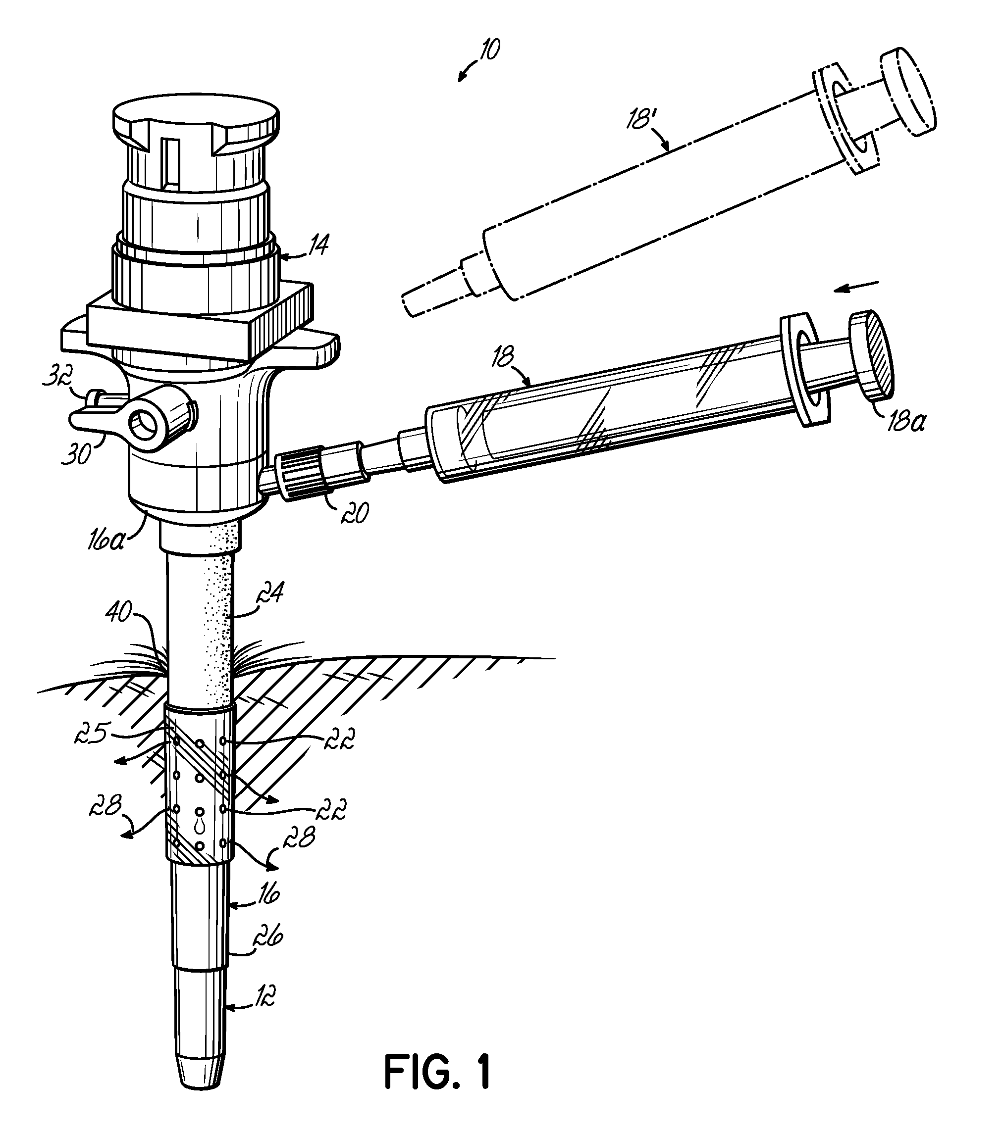 Trocar-cannula complex, cannula and method for delivering biologically active agents during minimally invasive surgery