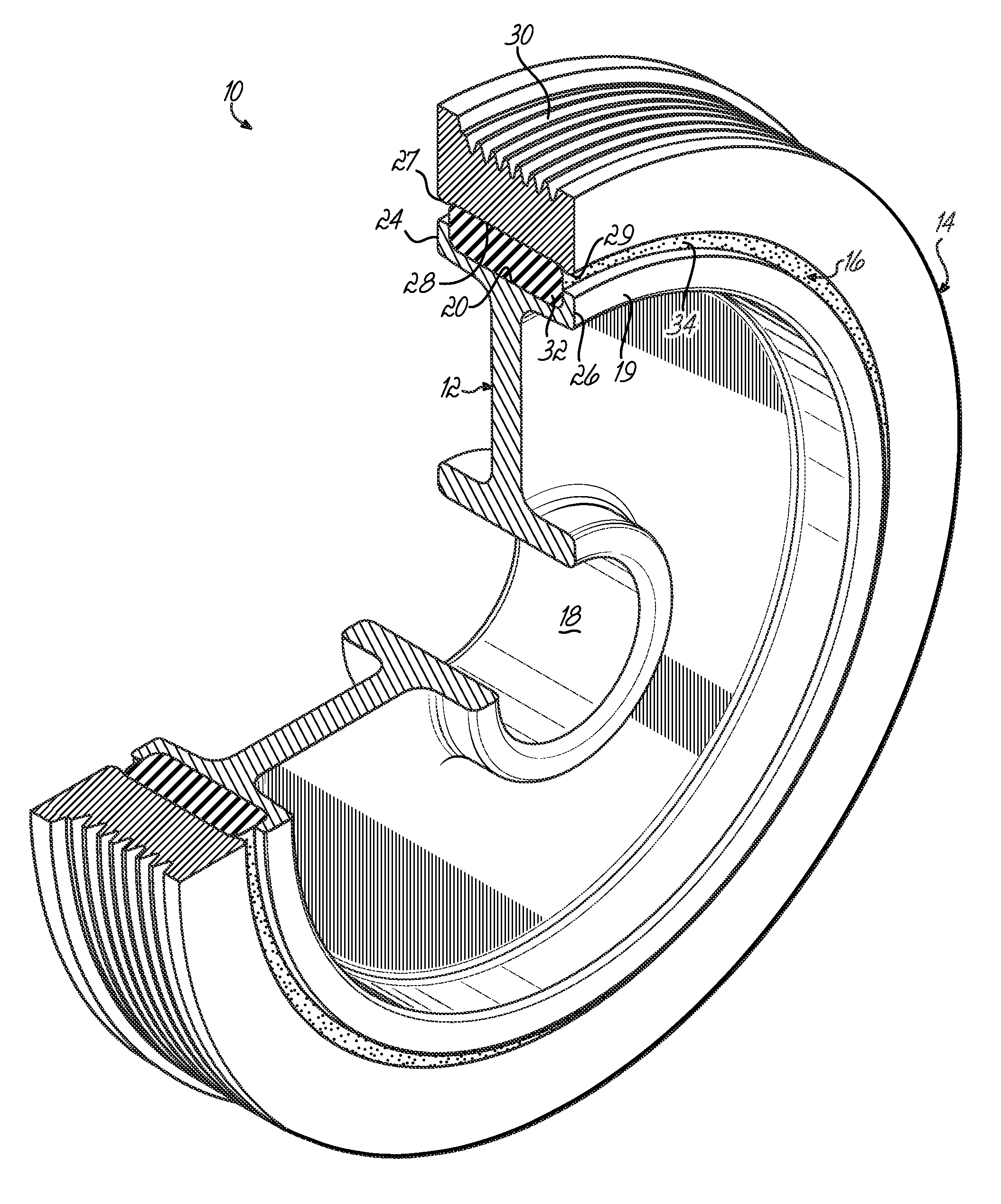 Recessed belt damper