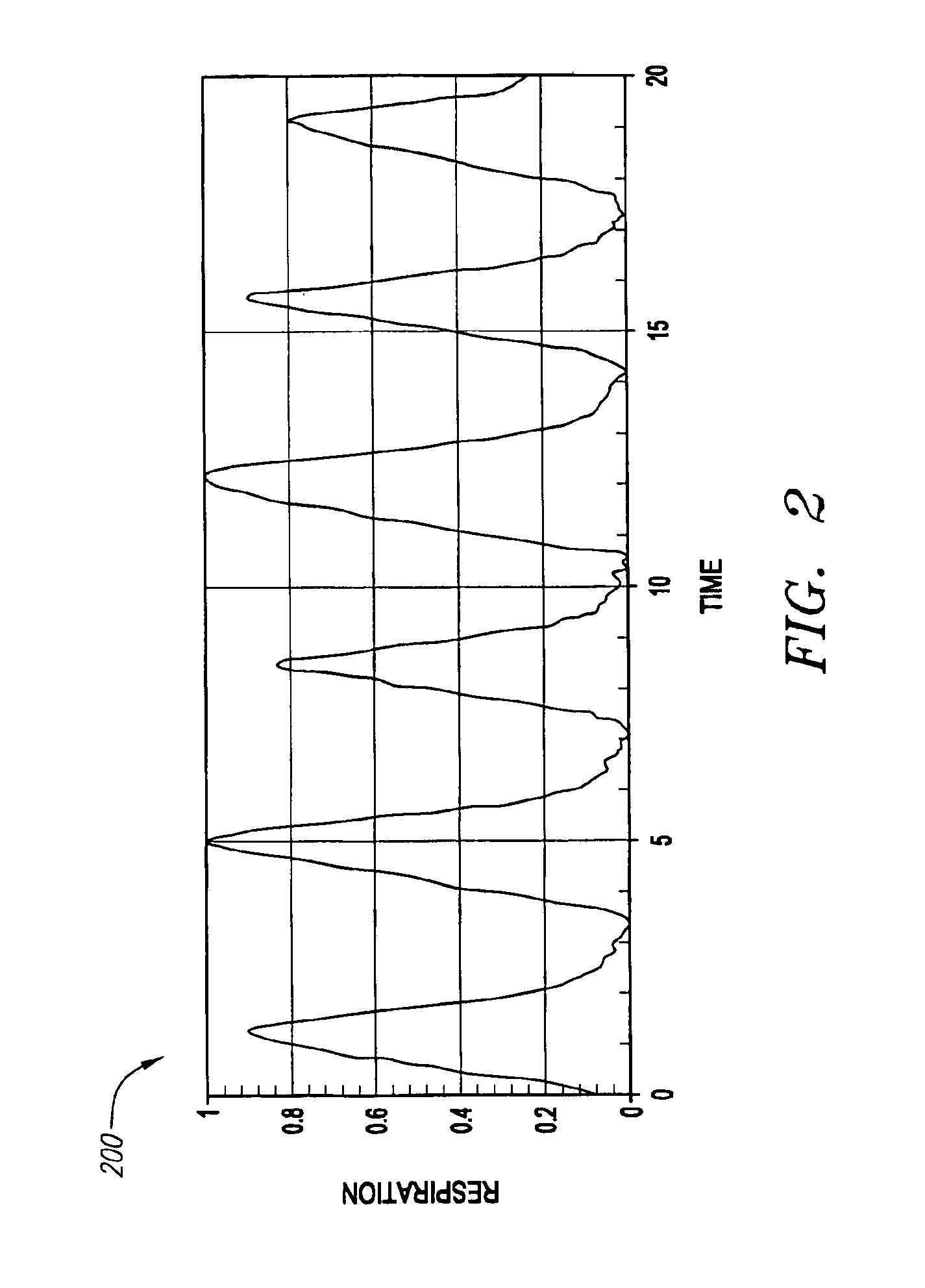 Method and system for monitoring breathing activity of a subject