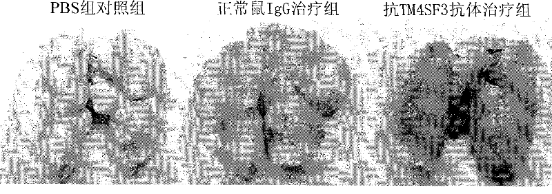 TM4SF3 protein for preparing antineoplastic antibody and use thereof