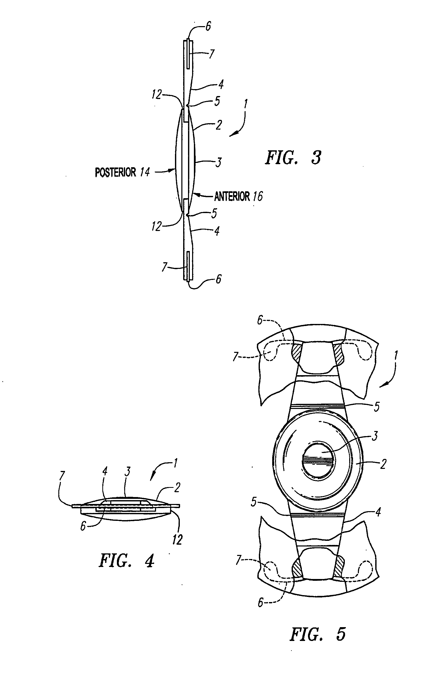 Polyspheric Accommodating Intraocular Lens