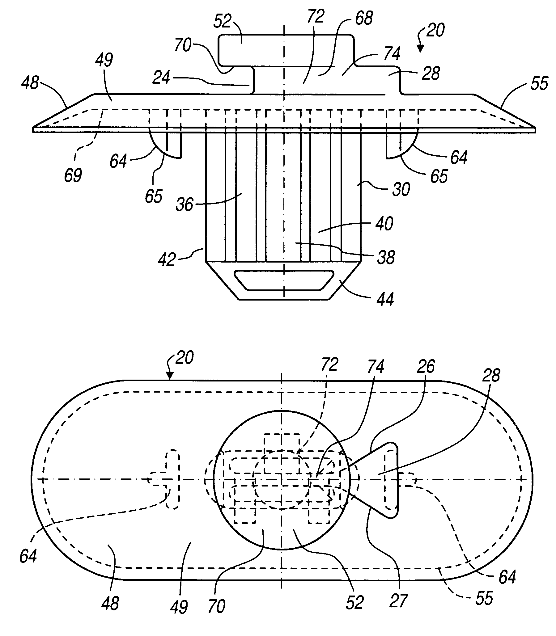 Sill plate retainer