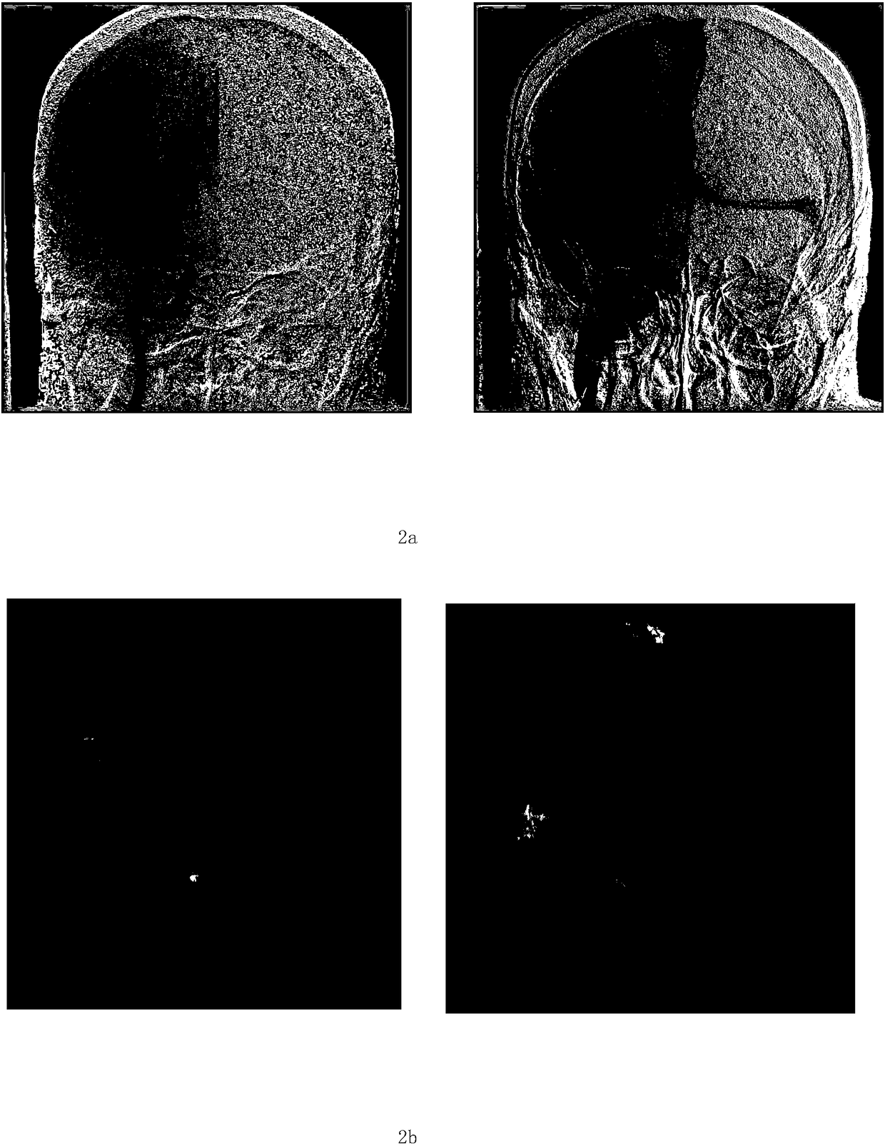 Multi-frame image blood vessel feature identification and information fusion-based color coding method