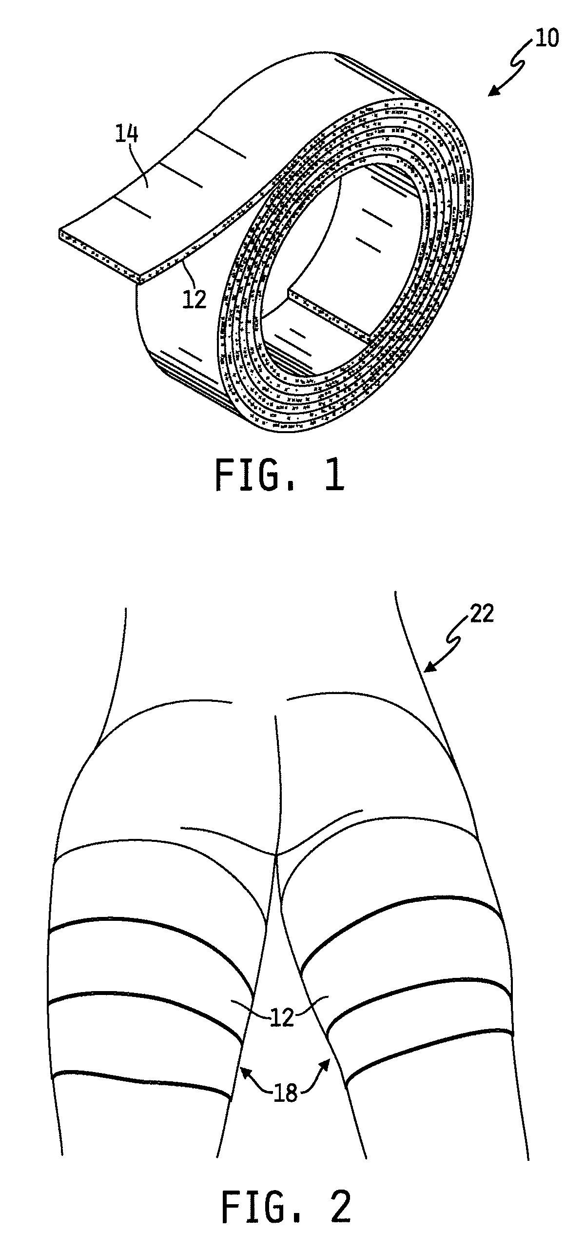 Method of using a compression bandage