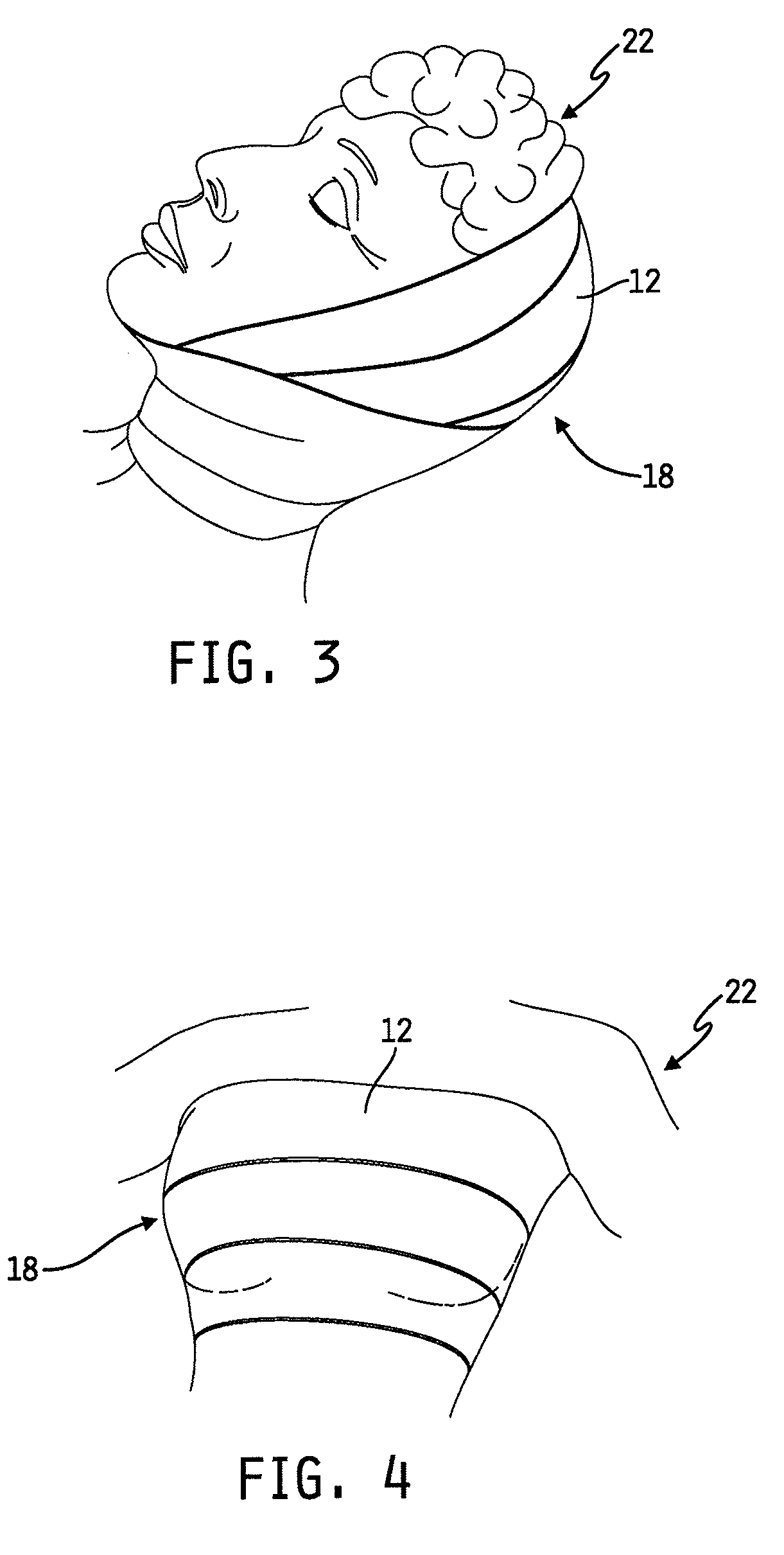 Method of using a compression bandage