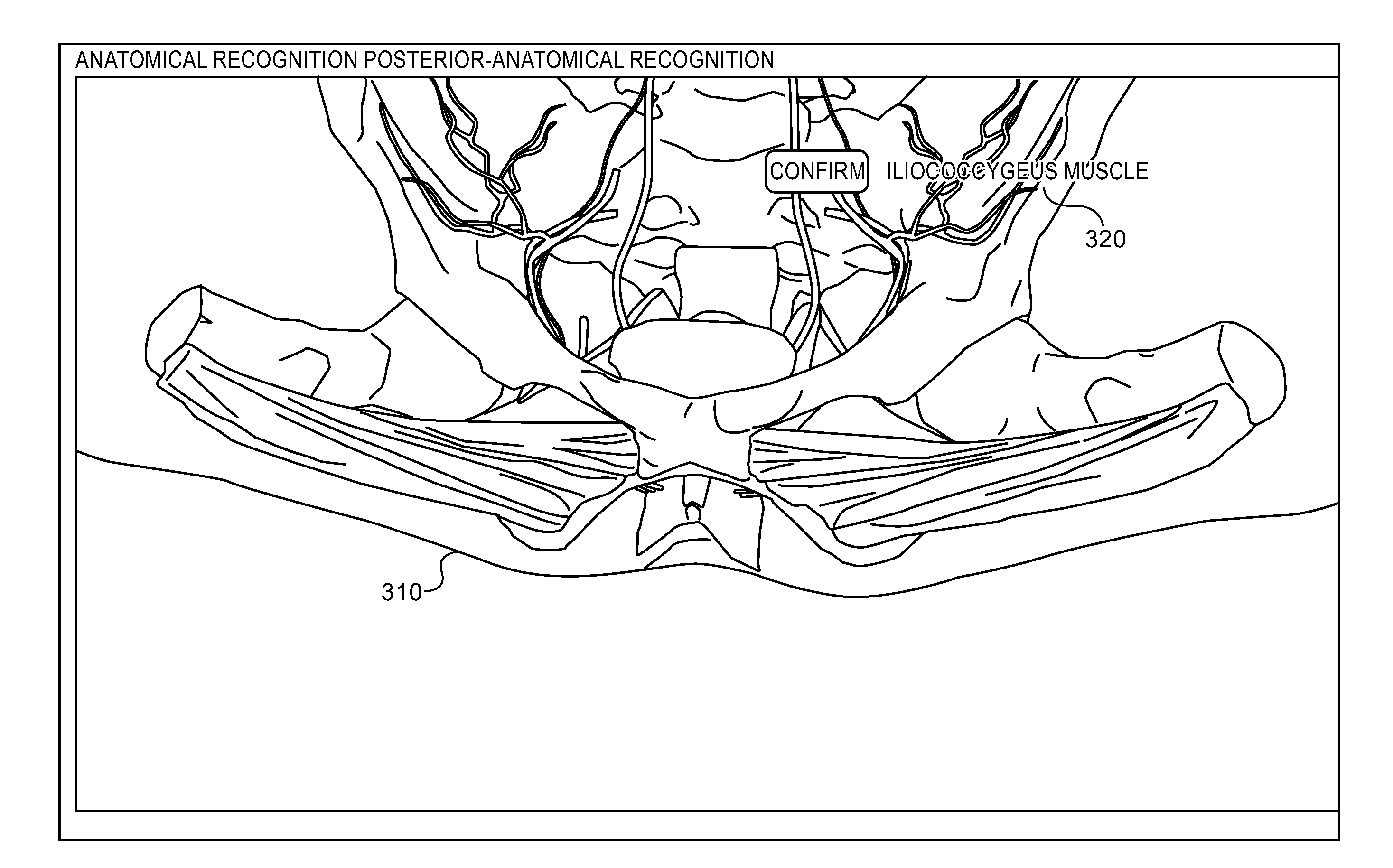 System and method for performing a hybrid simulation of a medical procedure