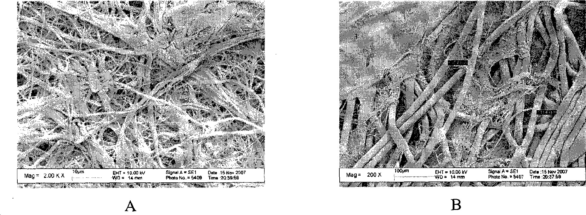 Multiple layer composite micropore filtration separation material and preparation method and use thereof