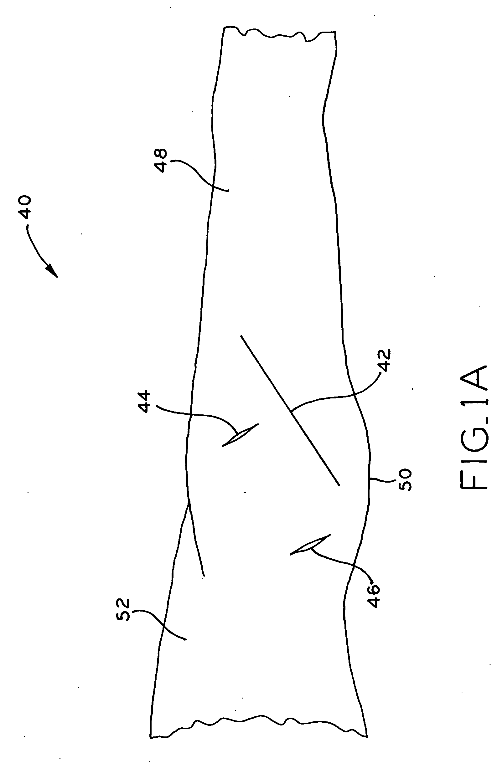 Method and apparatus for performing a minimally invasive total hip arthroplasty