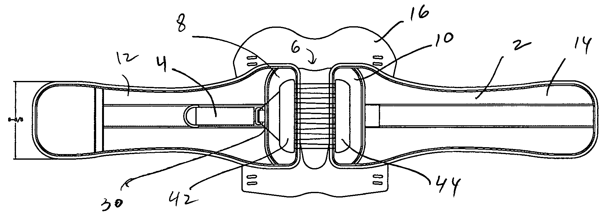 Orthosis closure system with mechanical advantage