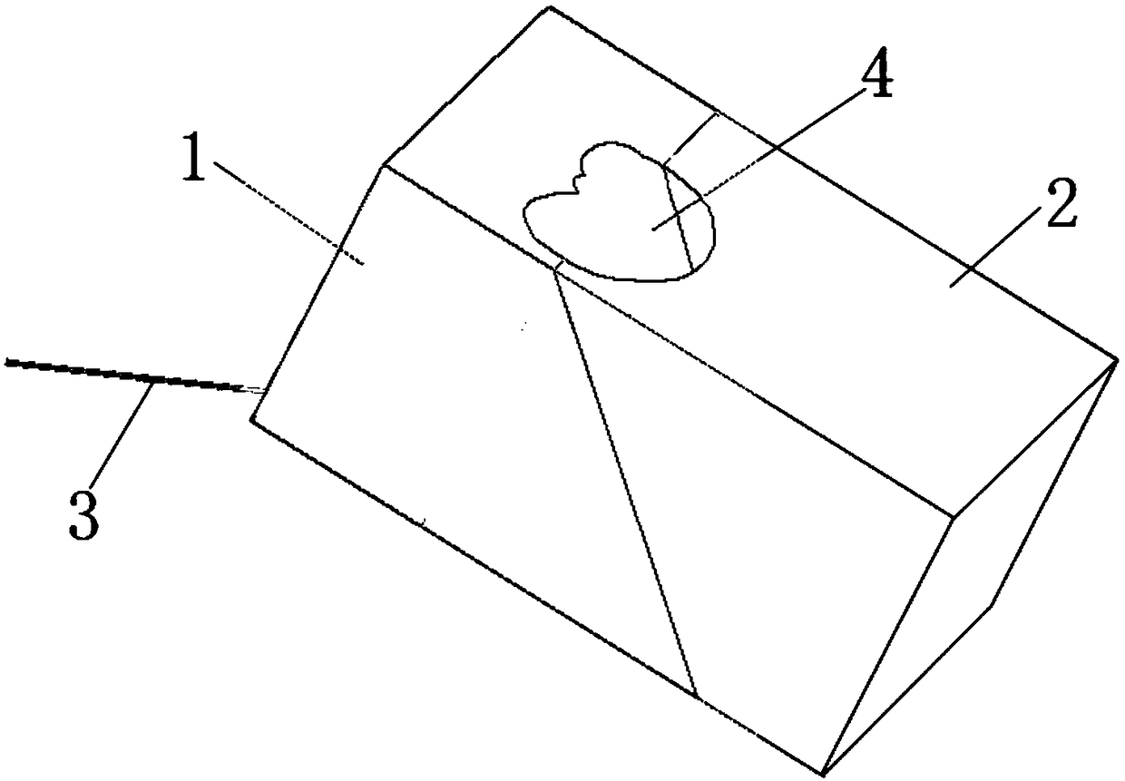 Surgical guide plate and method for percutaneous fixation of wrist fracture