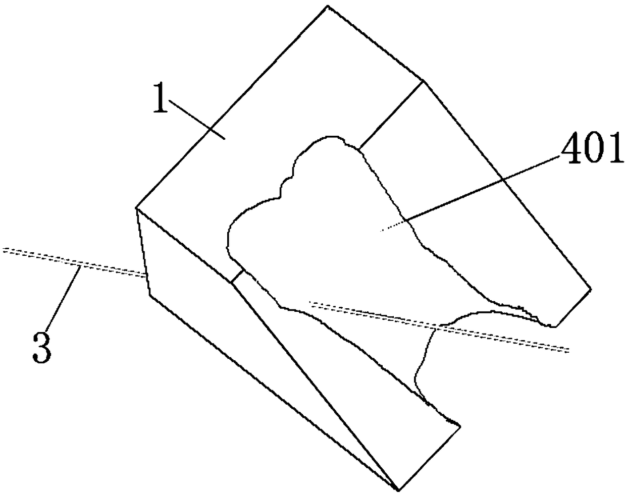 Surgical guide plate and method for percutaneous fixation of wrist fracture