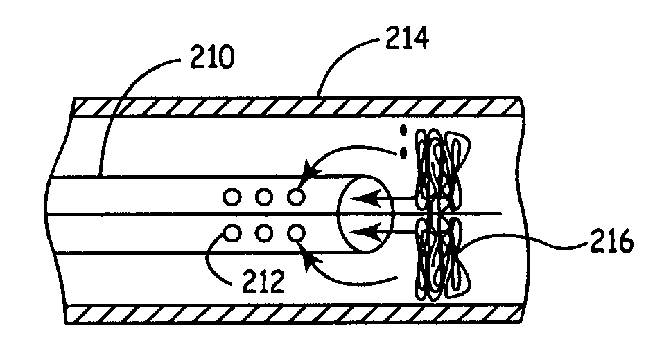 Emboli filter export system