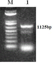 Livin-based immune-stimulating complex, preparation method thereof and application thereof