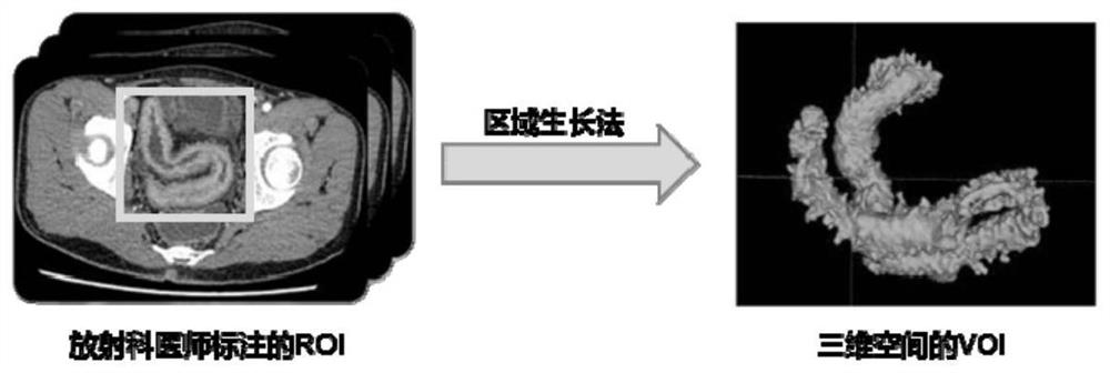 Infliximab efficacy prediction method and terminal equipment for Crohn's disease