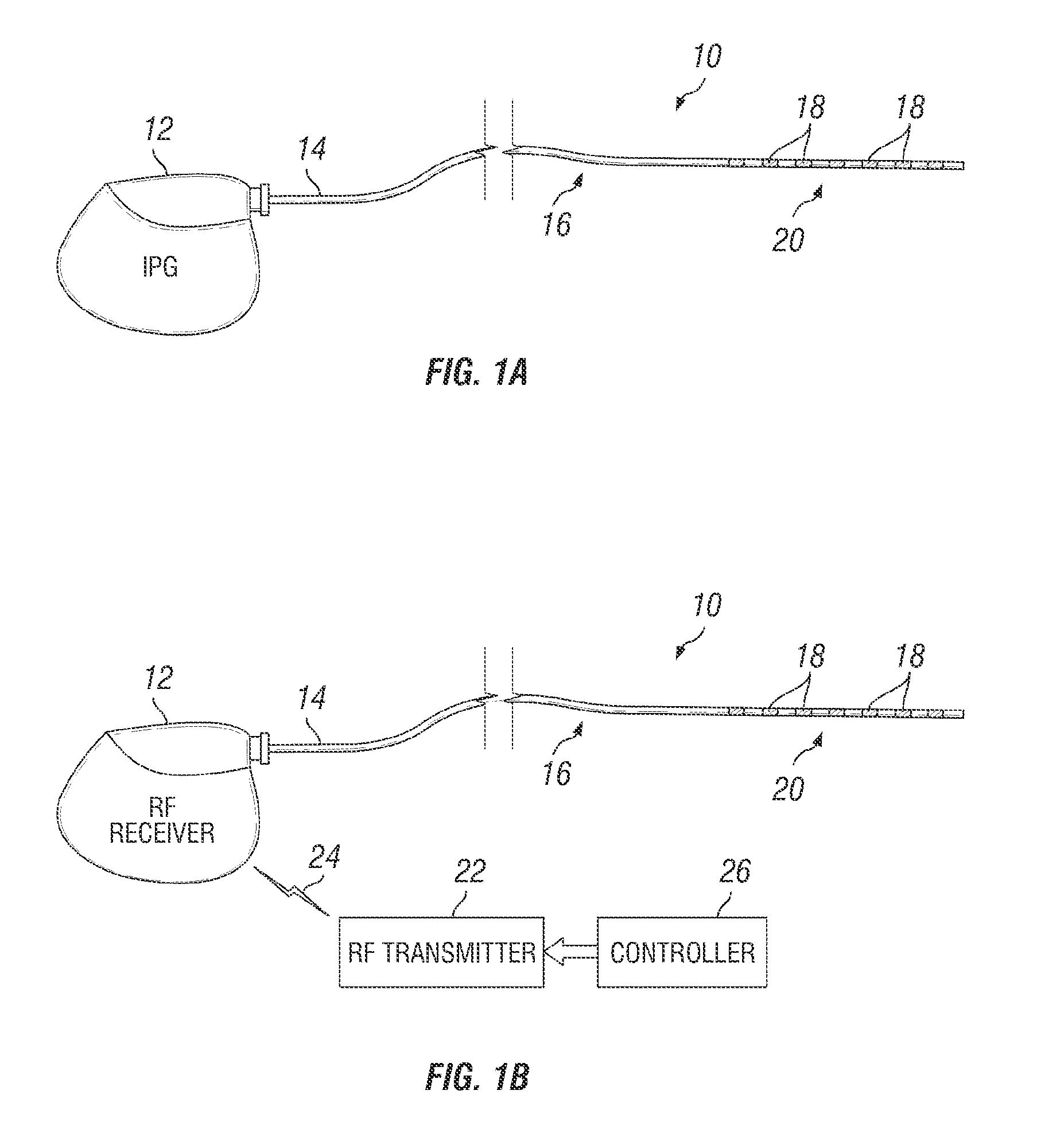 Method of using spinal cord stimulation to treat neurological disorders or conditions