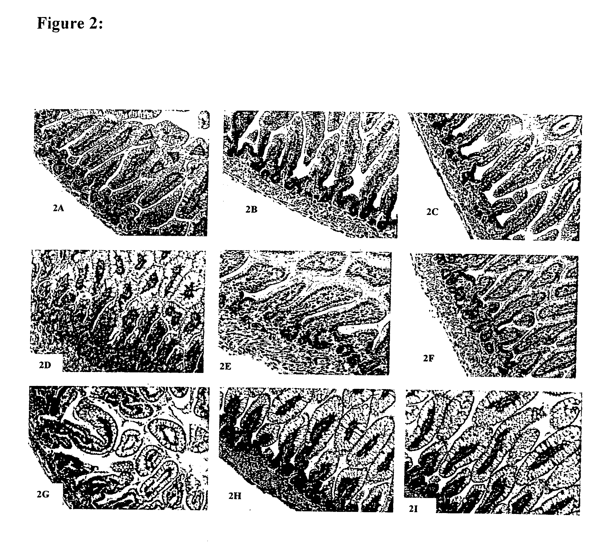 Method for treating or preventing systemic inflammation in formula-fed infants