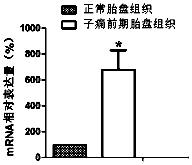 Application of znf770 gene in preparation of products for diagnosis and treatment of preeclampsia