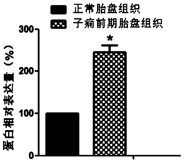 Application of znf770 gene in preparation of products for diagnosis and treatment of preeclampsia