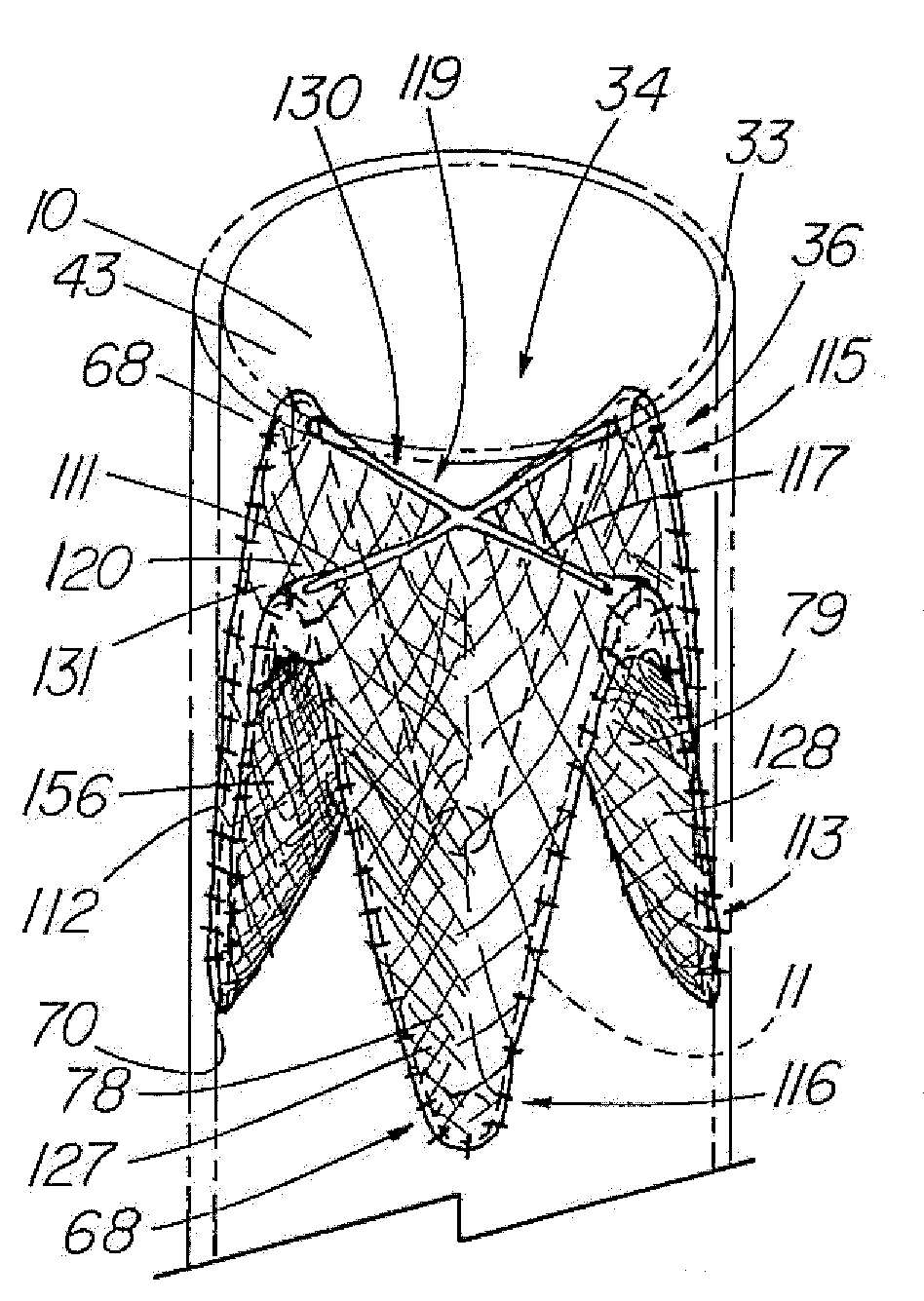 Implantable vascular device