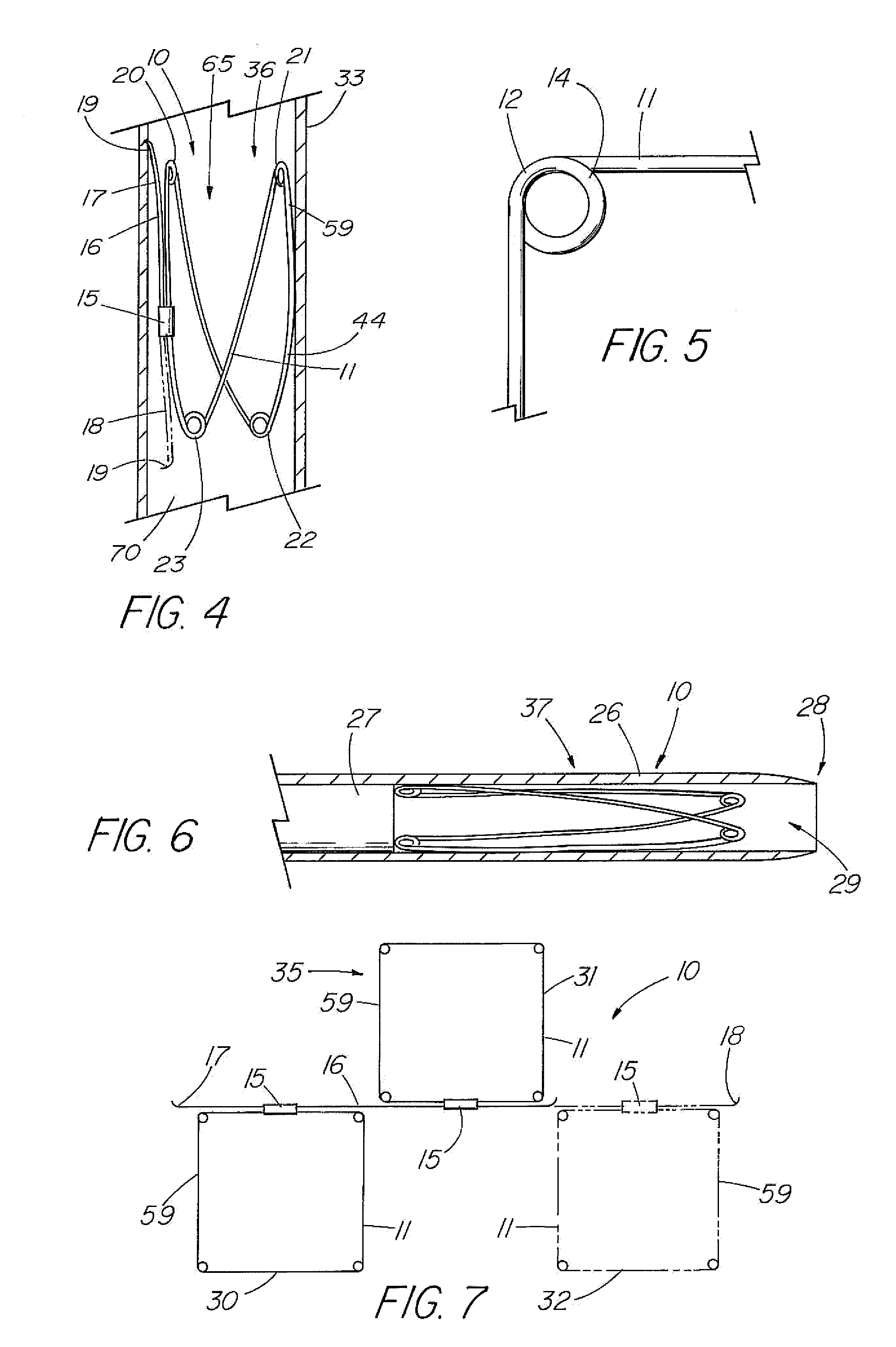 Implantable vascular device