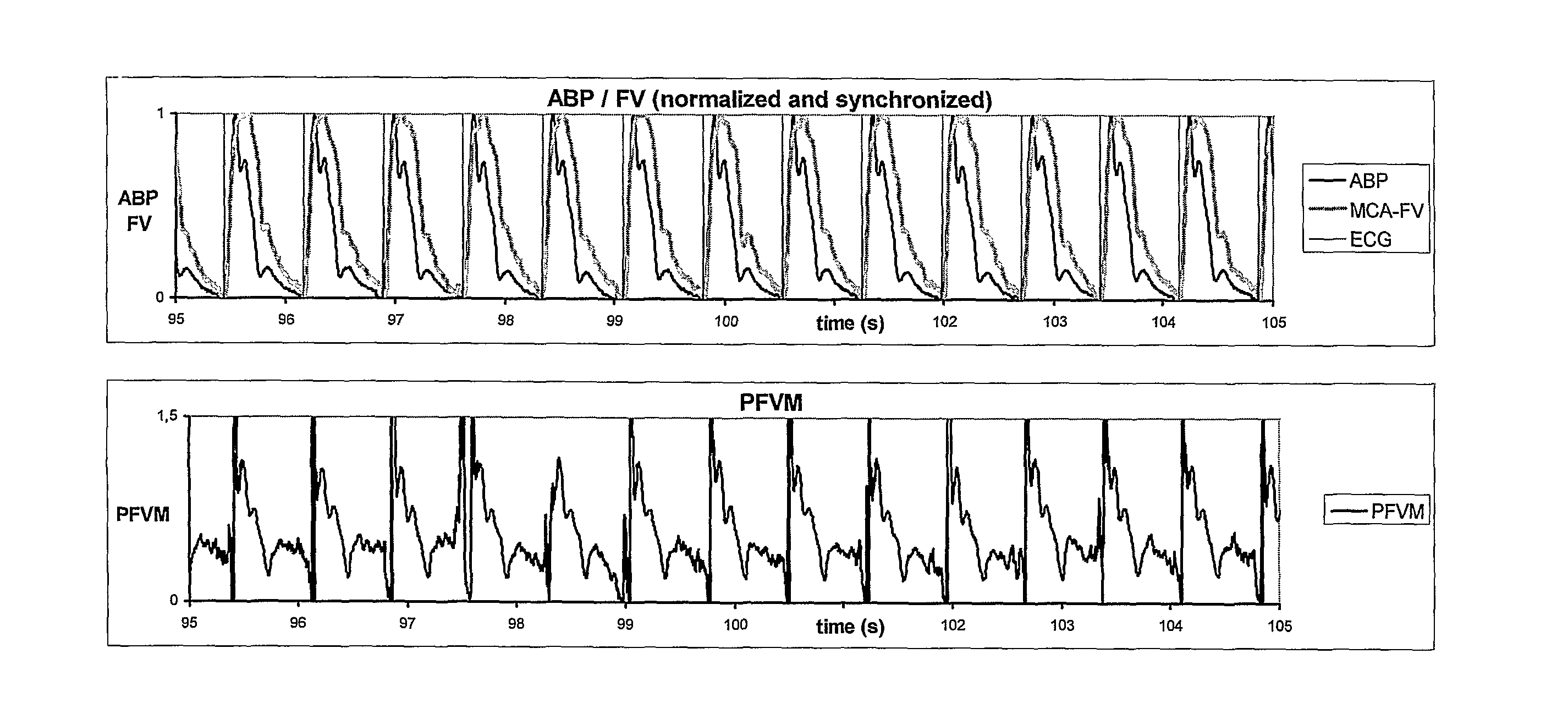 System for measuring pulsatile vascular resistance