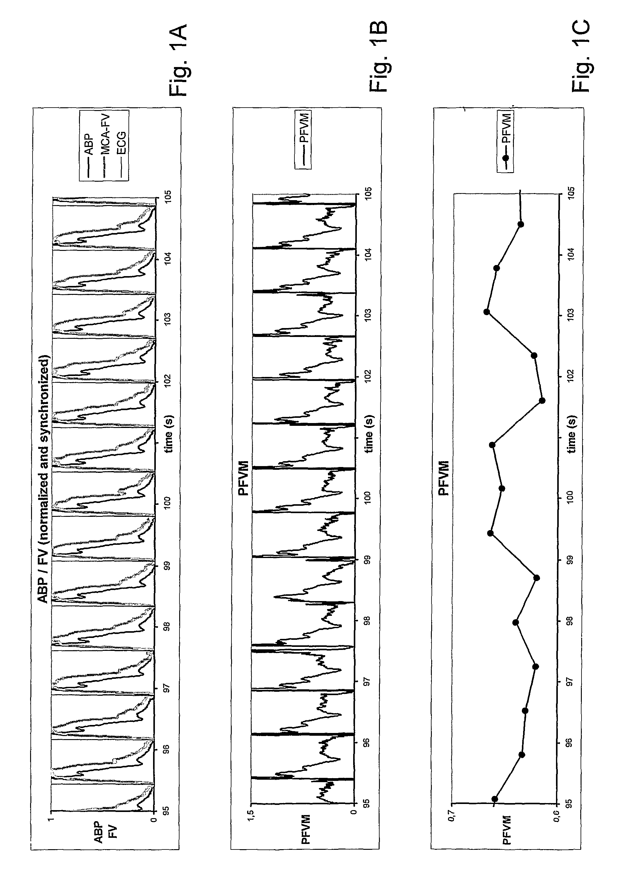 System for measuring pulsatile vascular resistance