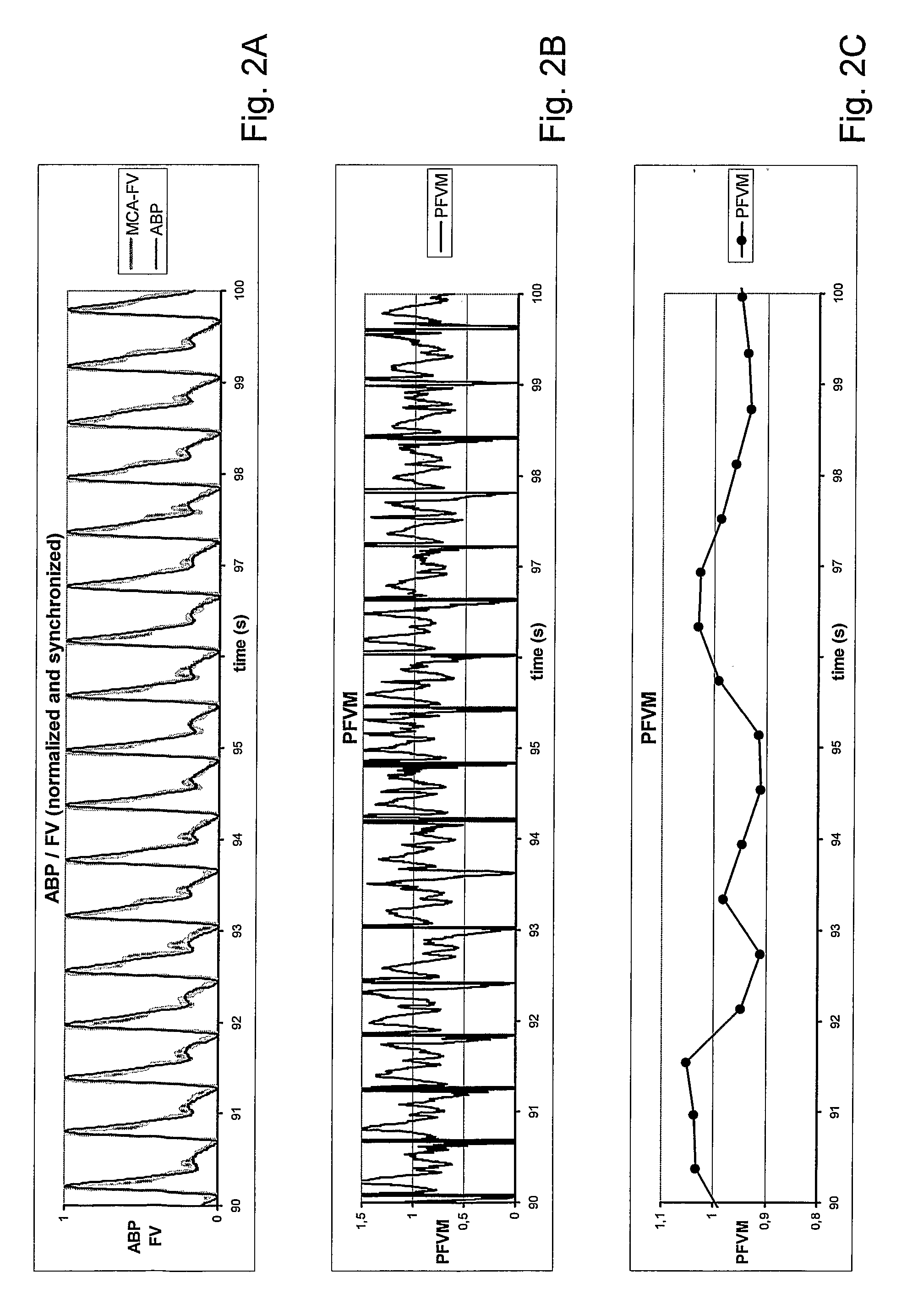 System for measuring pulsatile vascular resistance