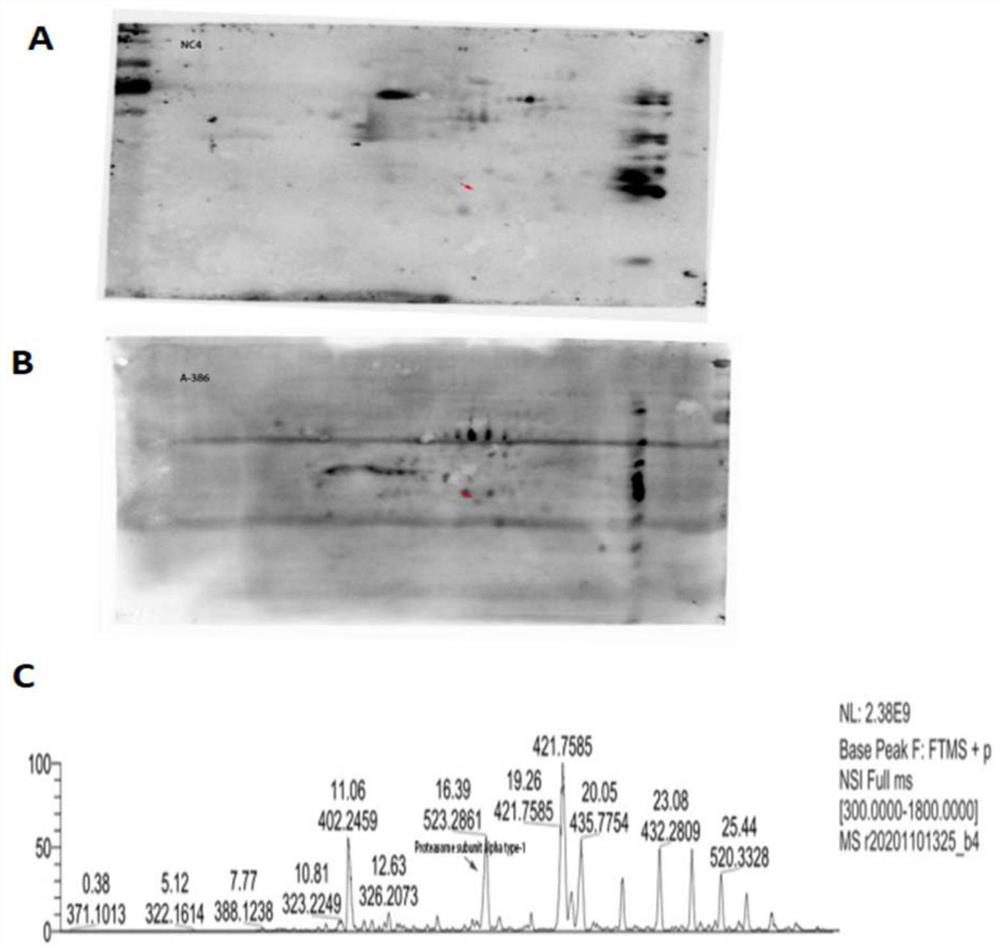 A kit for detecting anti-proteasome subunit α1-igg antibody