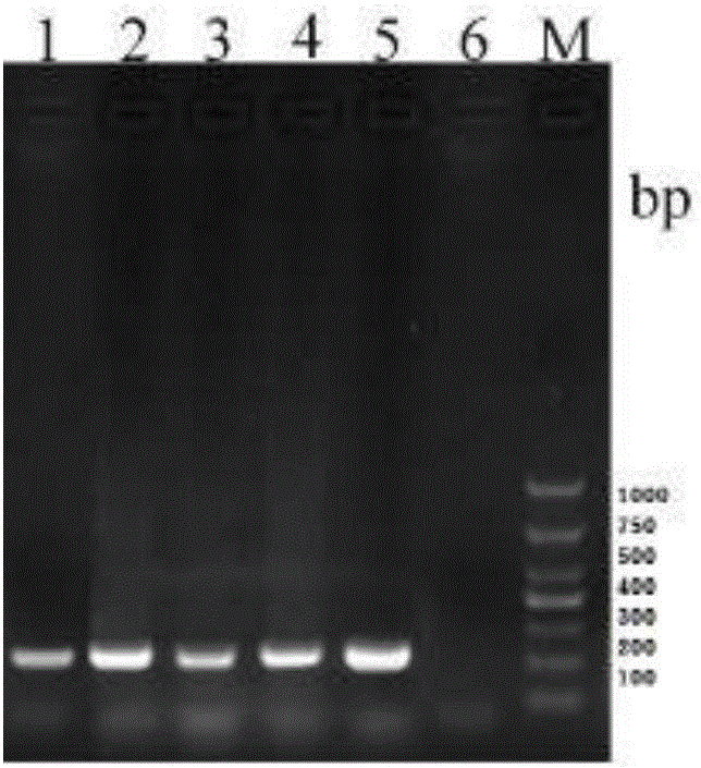 Grass carp reovirus II type vaccine strain and wild strain diagnostic primer, kit employing diagnostic primer and diagnostic detection method