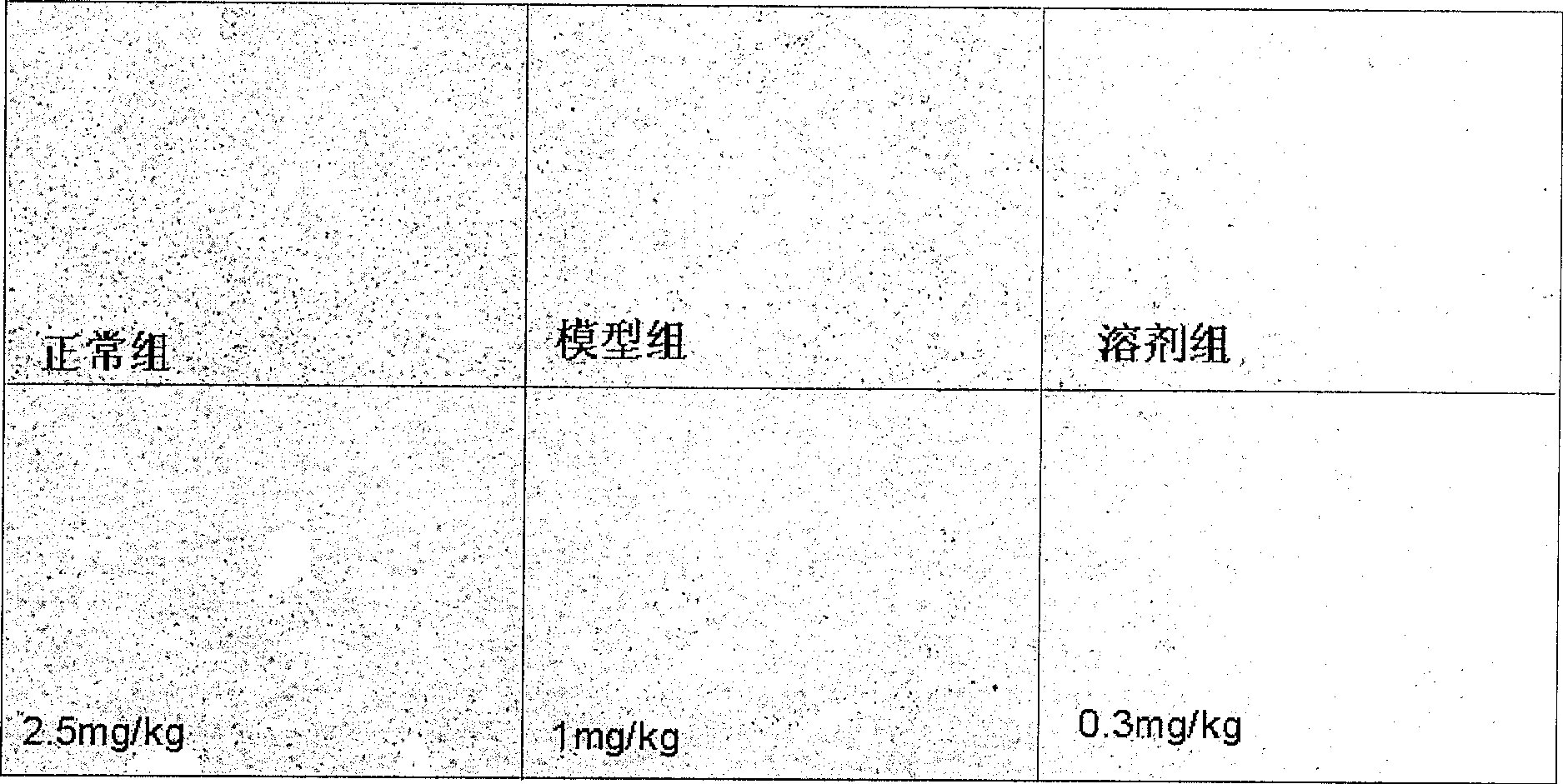 Application of dammarane triterpenes derivative and drug composition containing dammarane triterpenes derivative