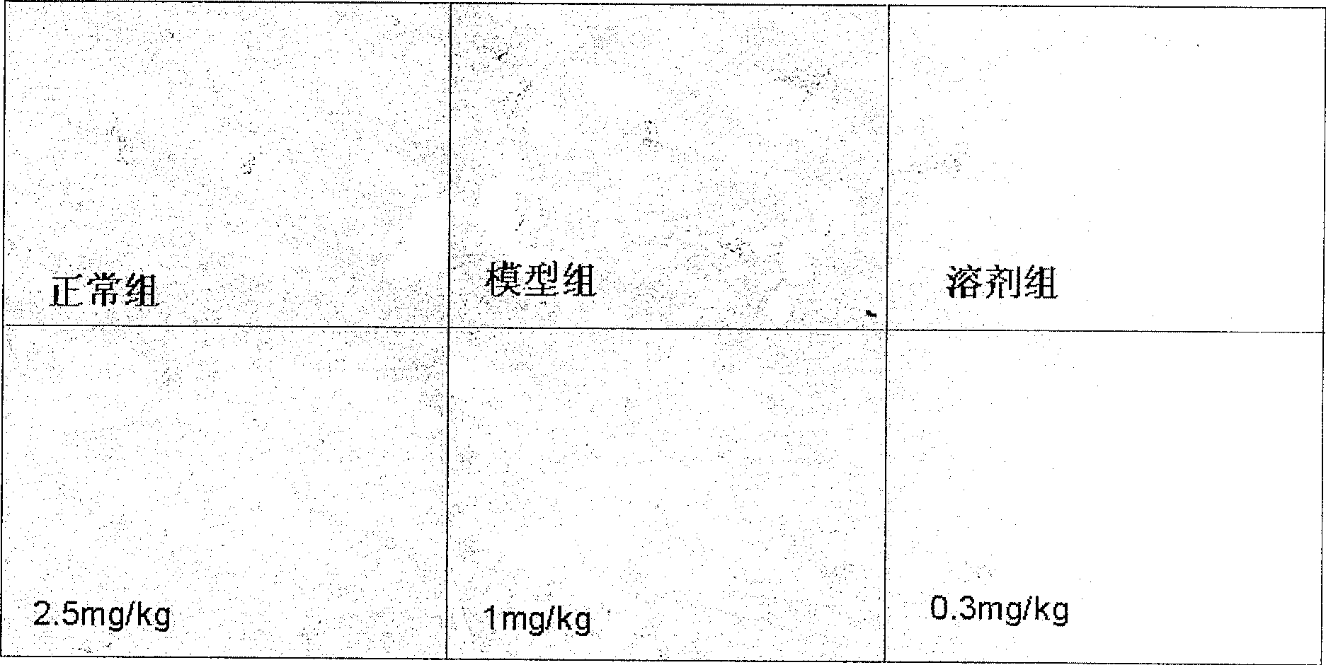 Application of dammarane triterpenes derivative and drug composition containing dammarane triterpenes derivative