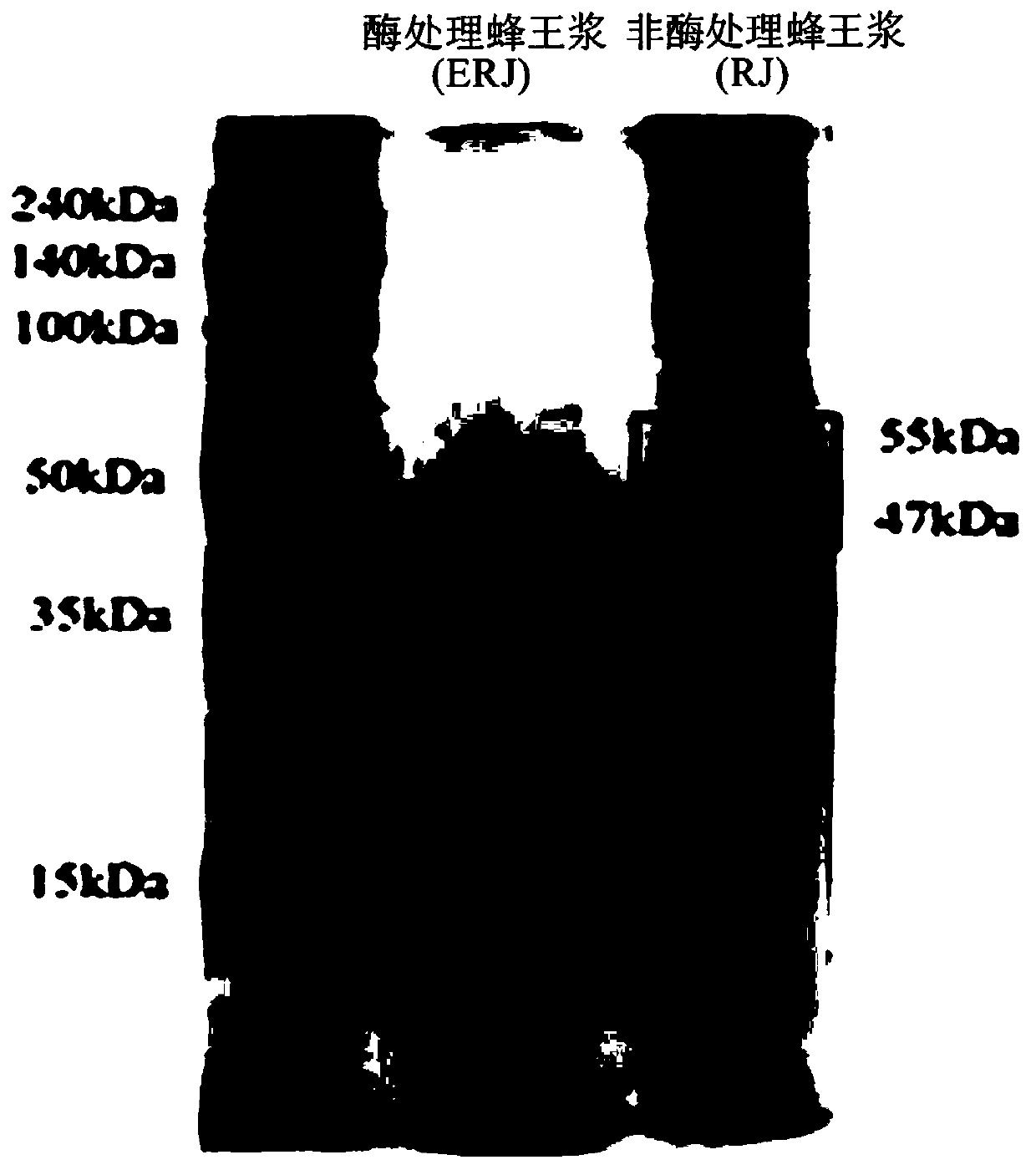 Pharmaceutical composition for enhancing immune function comprising enzyme treated royal jelly powder as an active ingredient