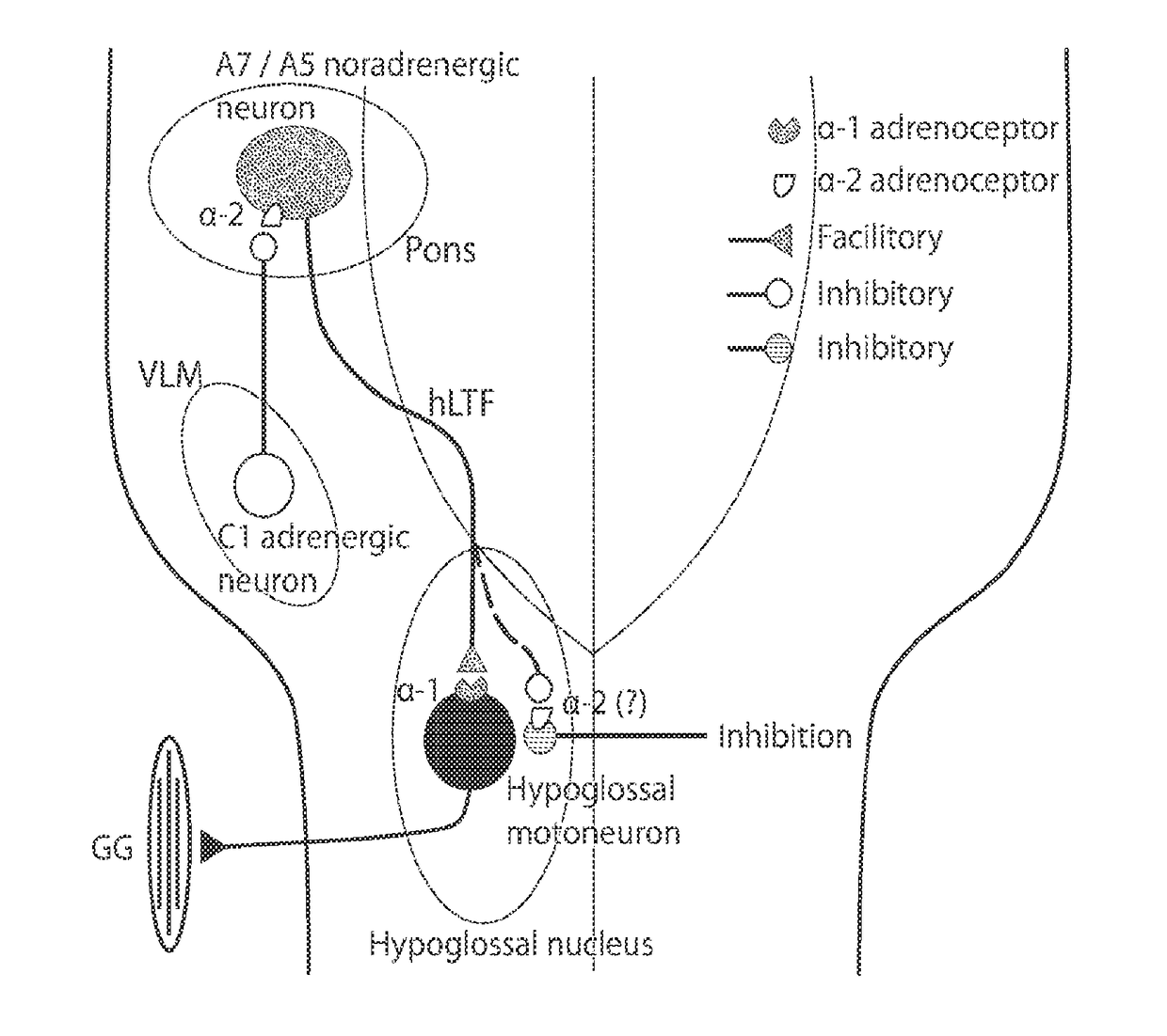 Noradrenergic drug treatment of obstructive sleep apnea