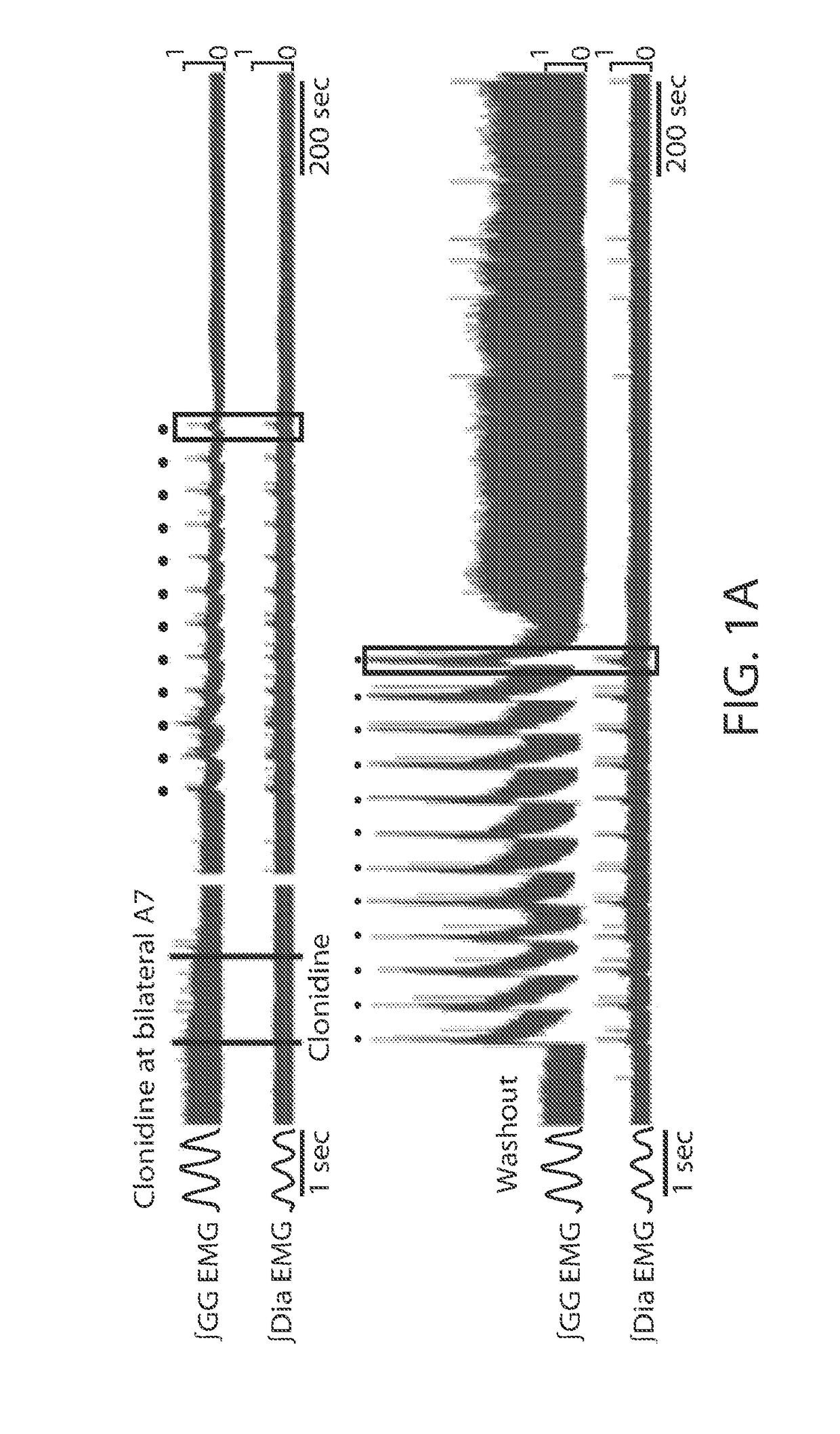 Noradrenergic drug treatment of obstructive sleep apnea