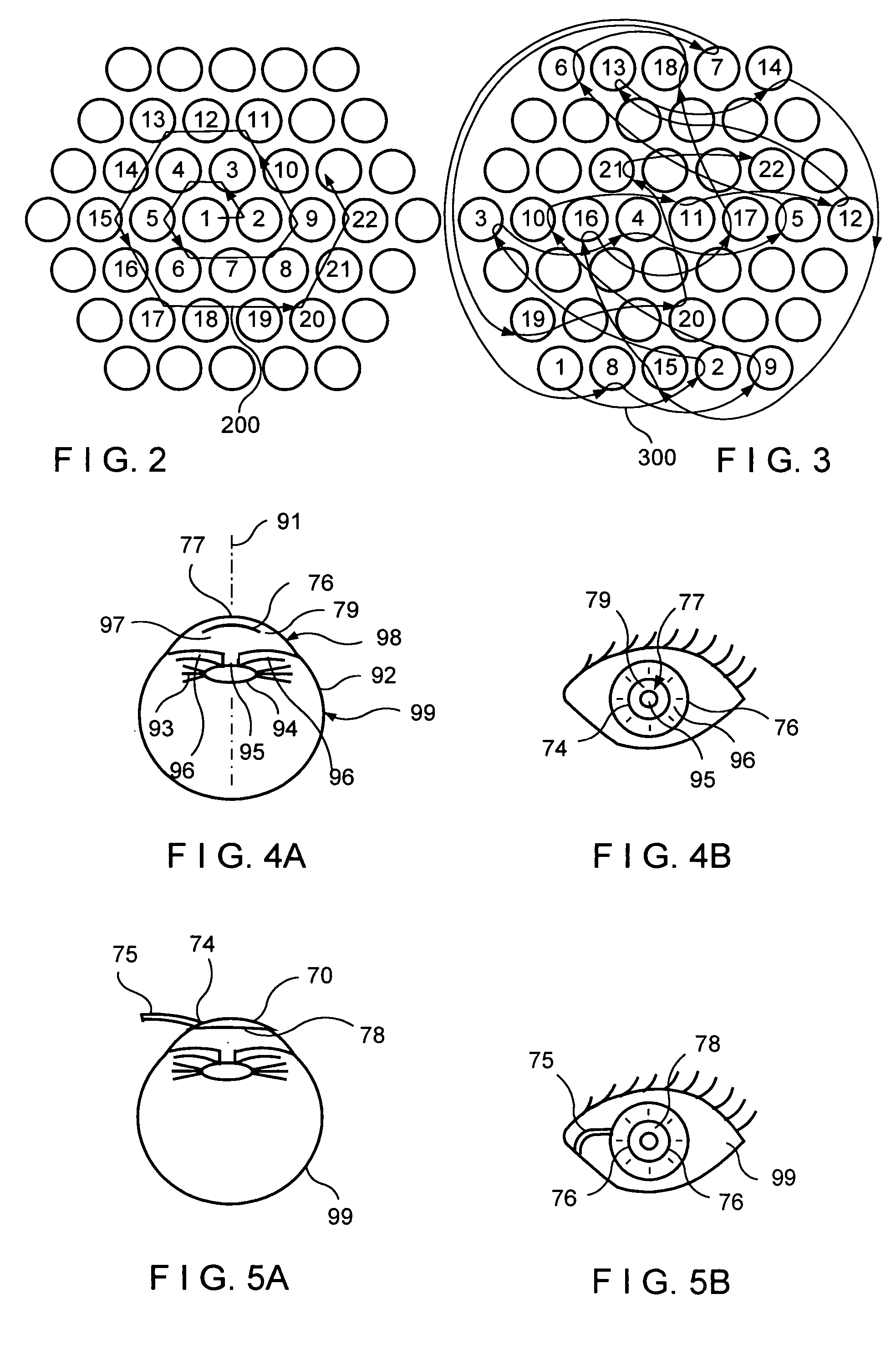 Apparatus and method for opthalmologic surgical procedures using a femtosecond fiber laser