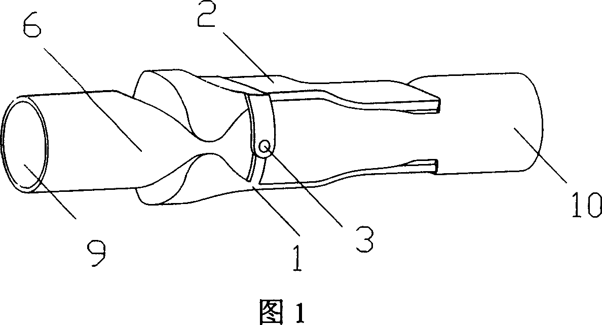 Indirect artificial valva outside vein