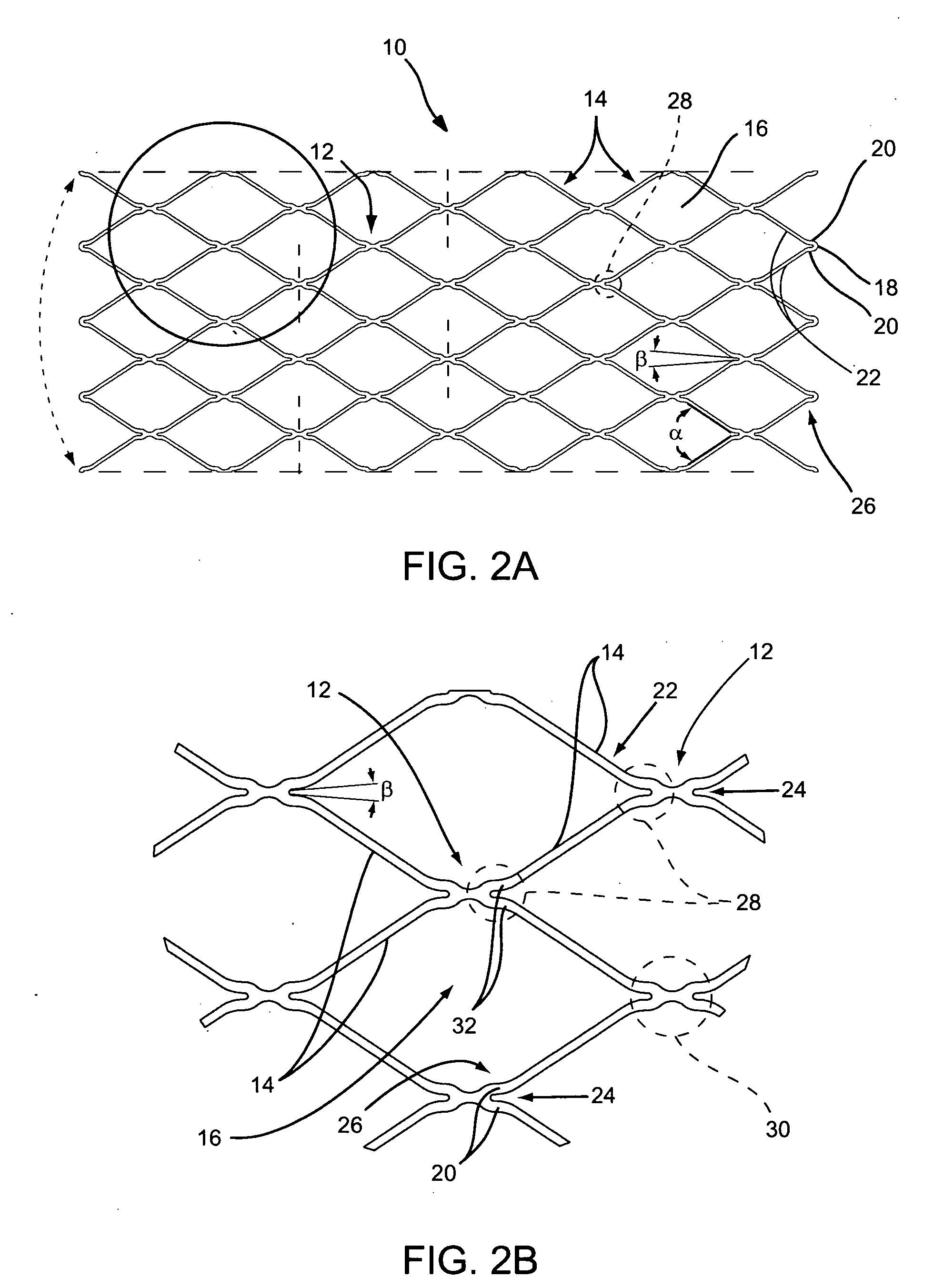 Staged stent delivery systems