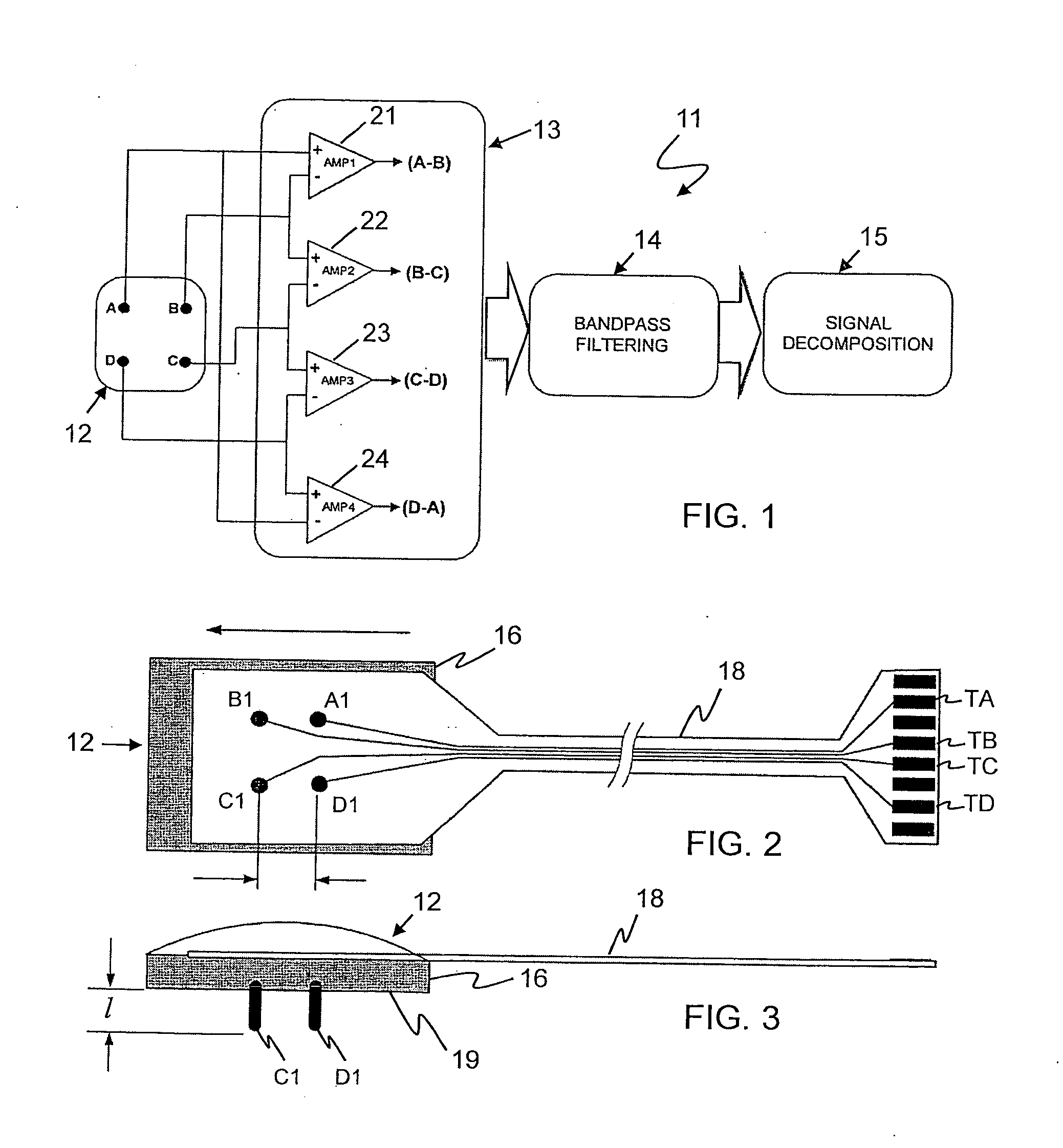 Sensor system for detecting and processing EMG signals